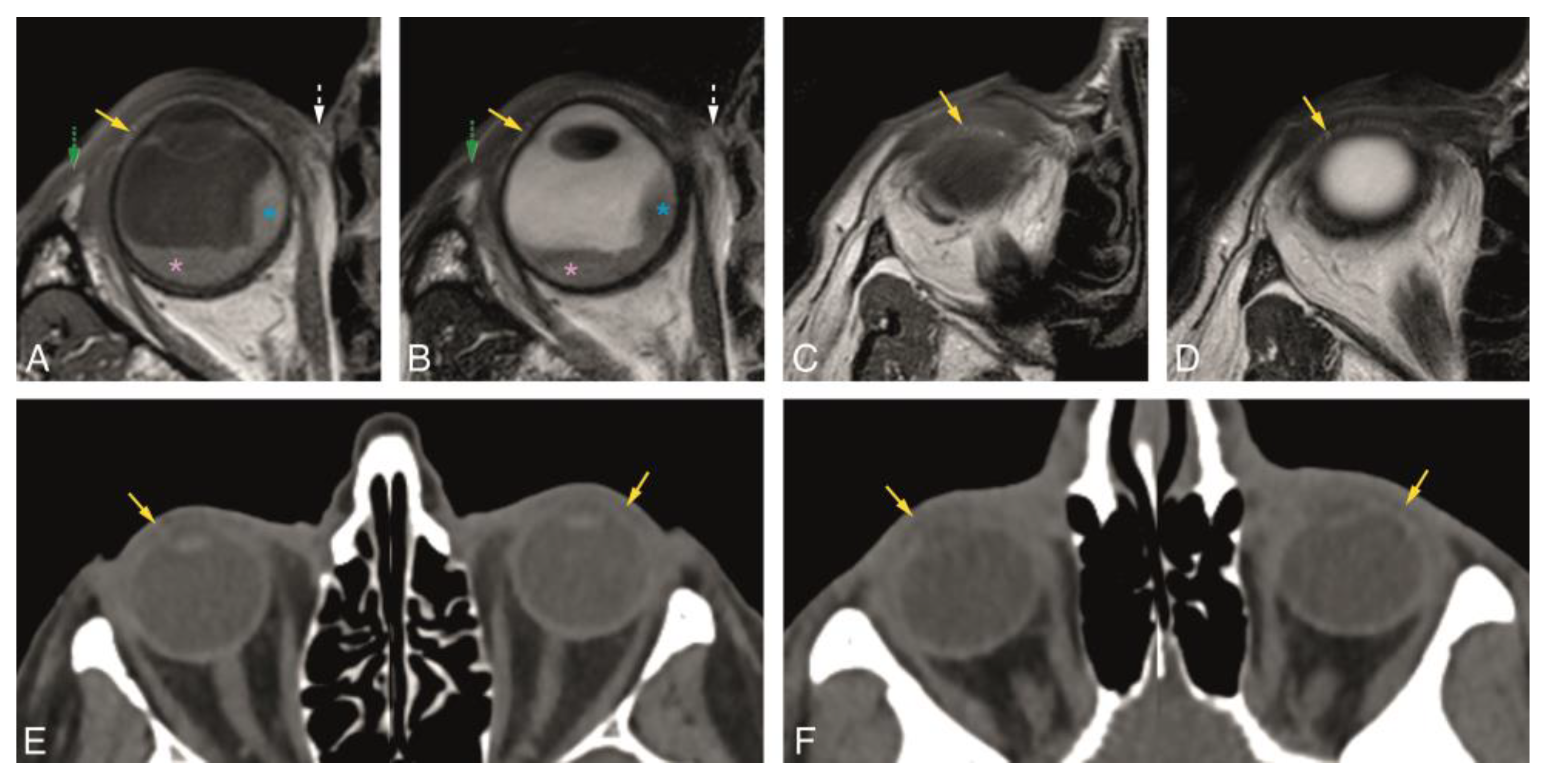 Cancers 12 00658 g003