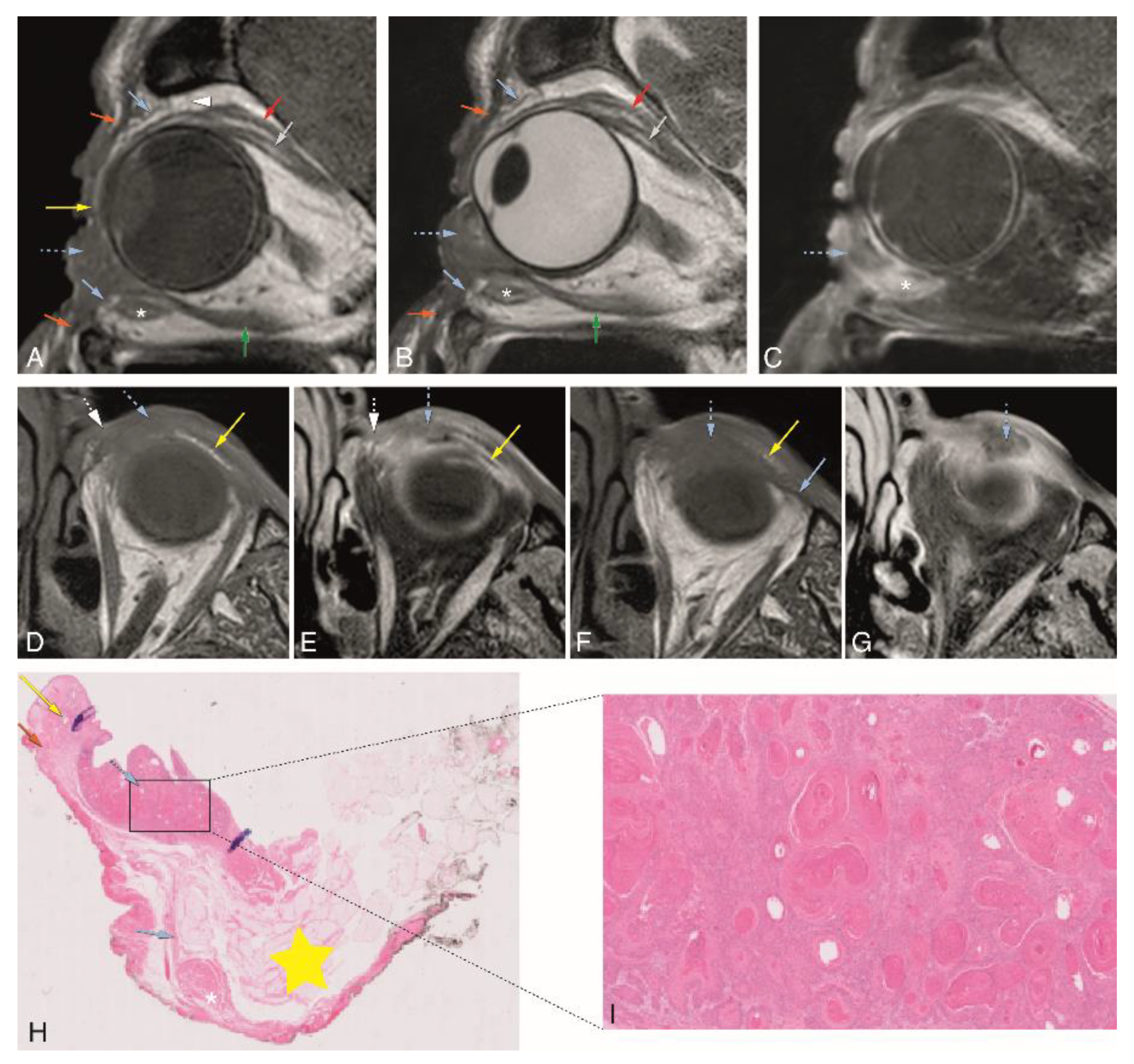 Cancers 12 00658 g005