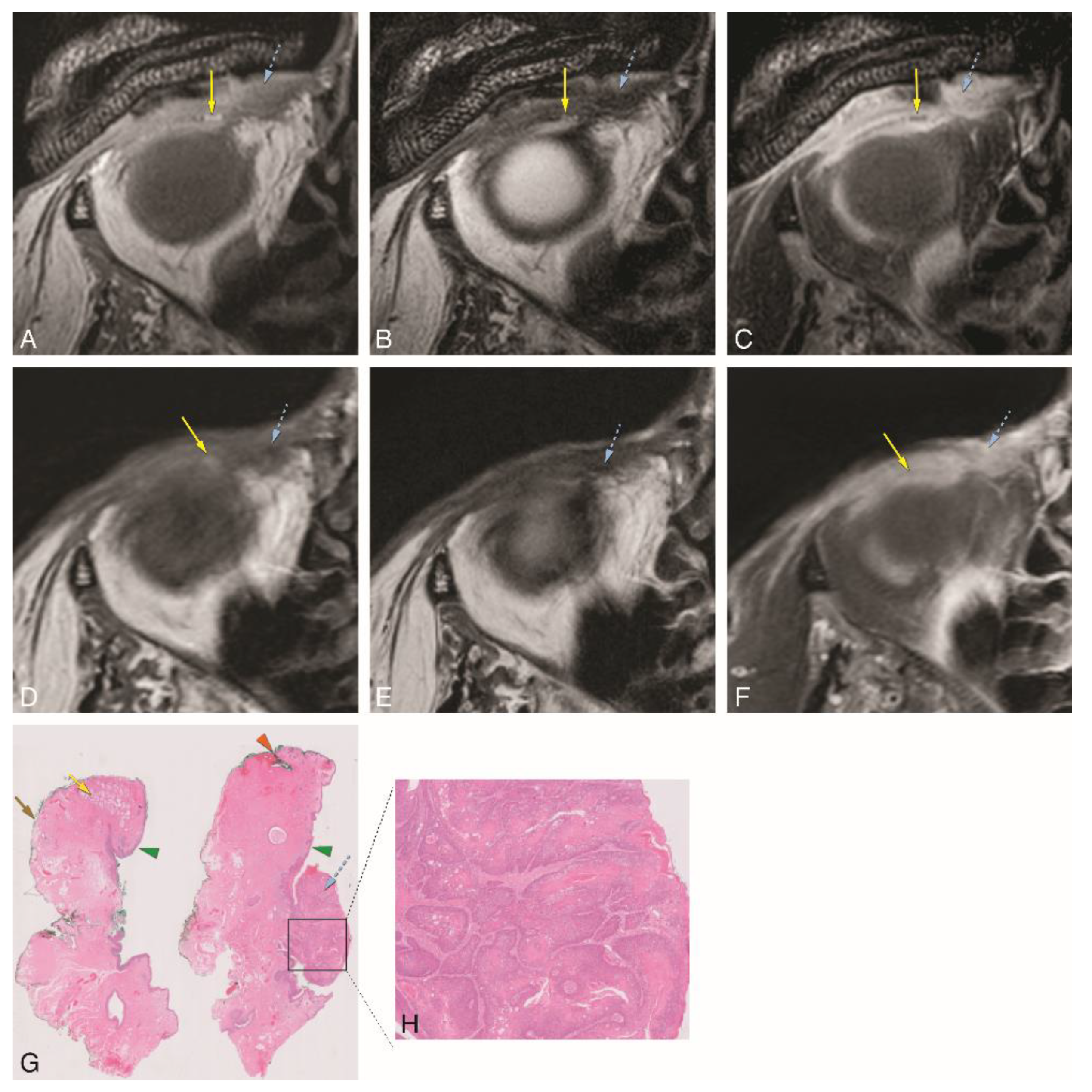 Cancers 12 00658 g006