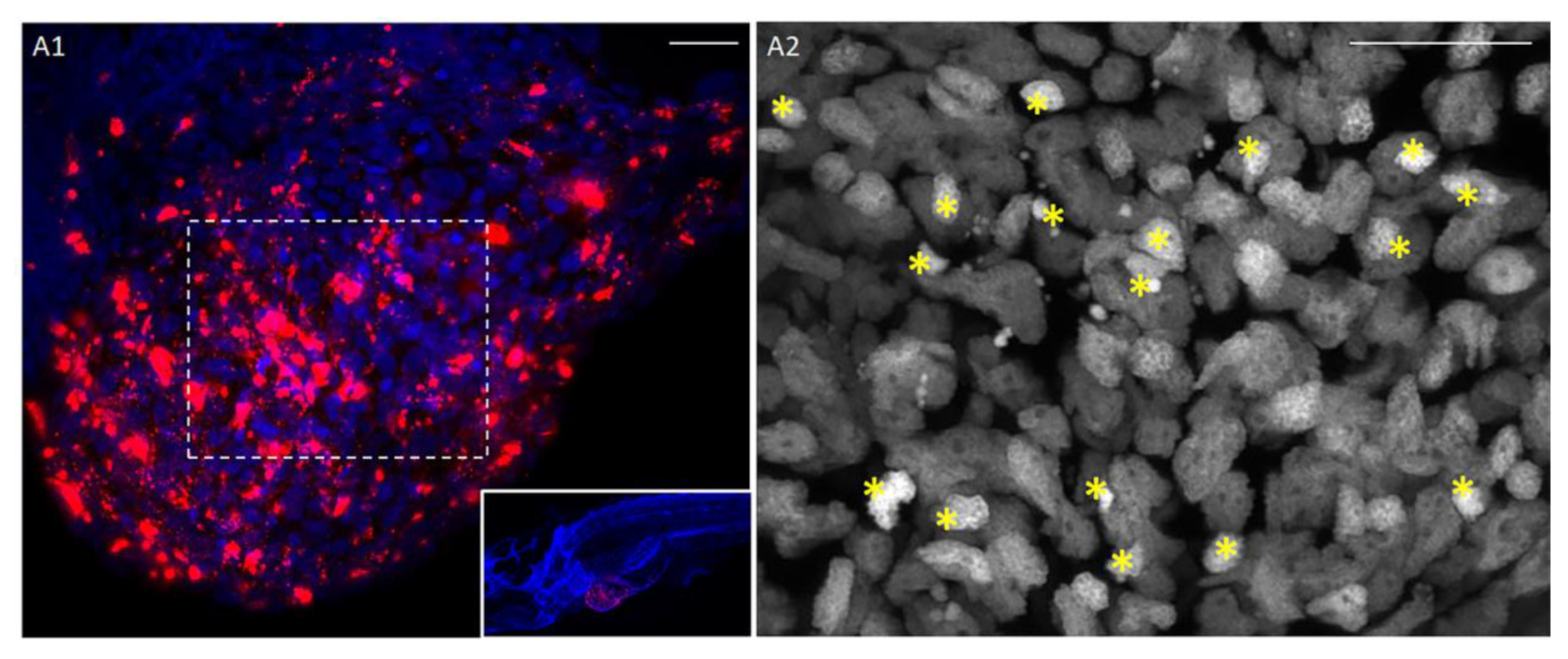Cancers 12 00677 g005 Cancers 12 00677 g005