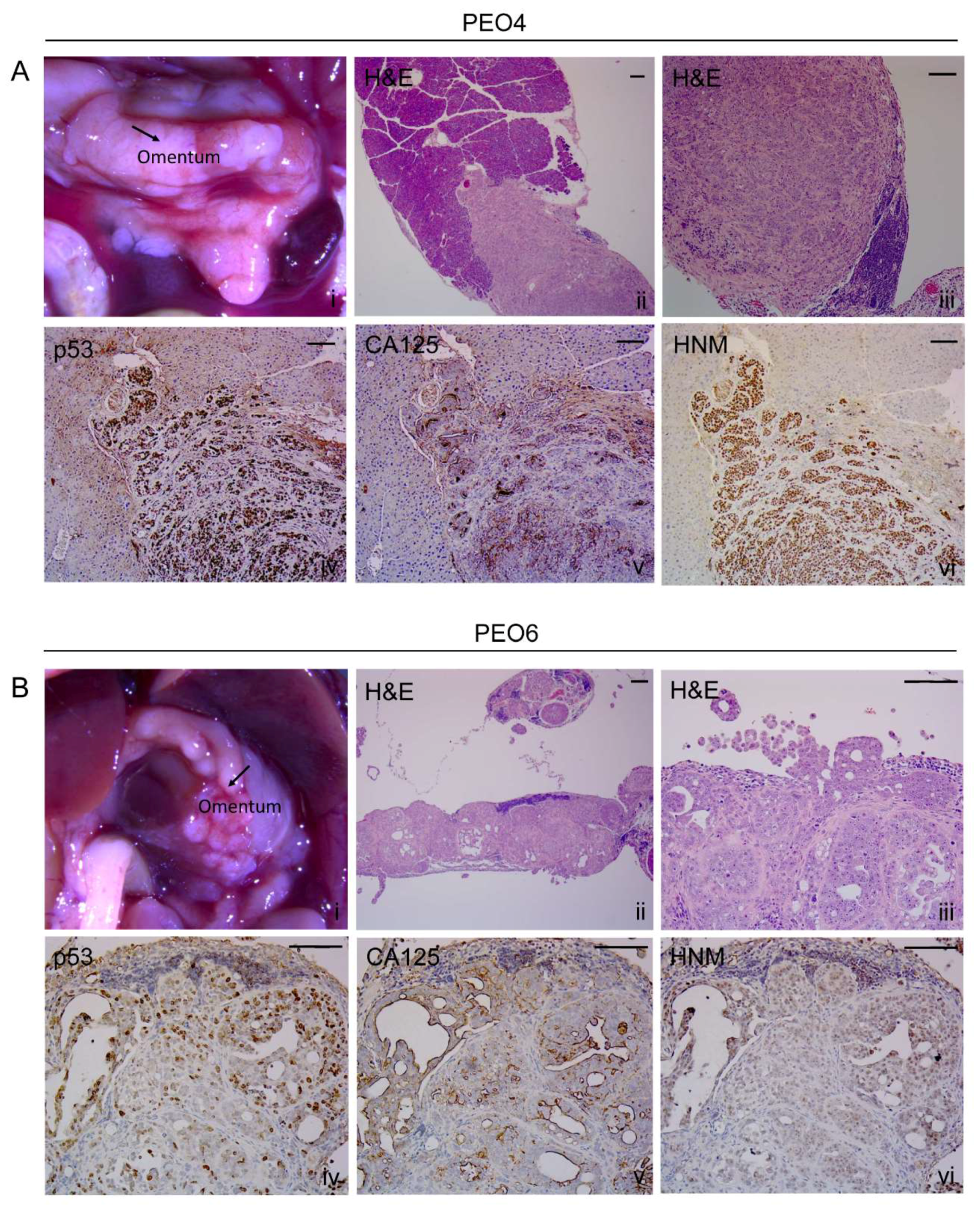 Cancers 12 00699 g005