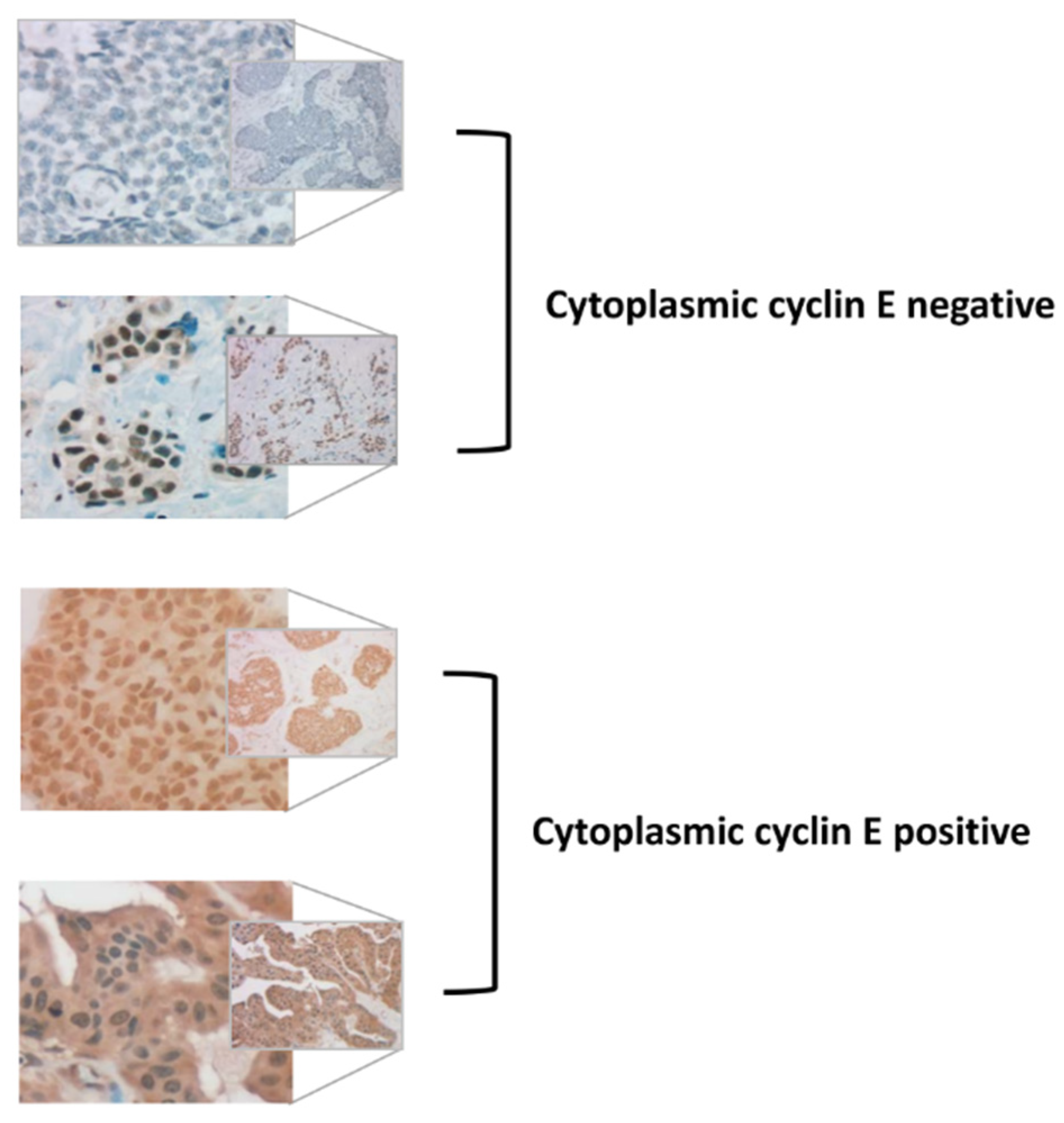 Cancers 12 00712 g002