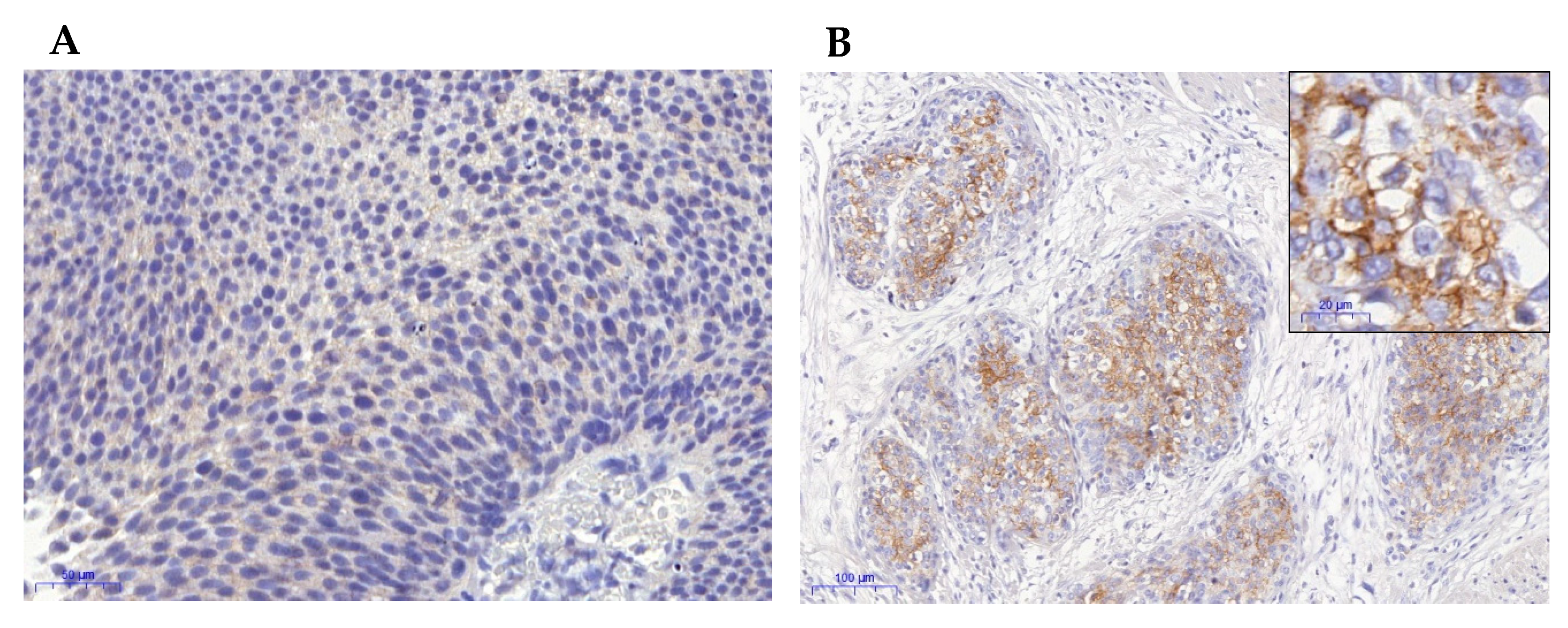 Cancers 12 00763 g002 Cancers 12 00763 g002