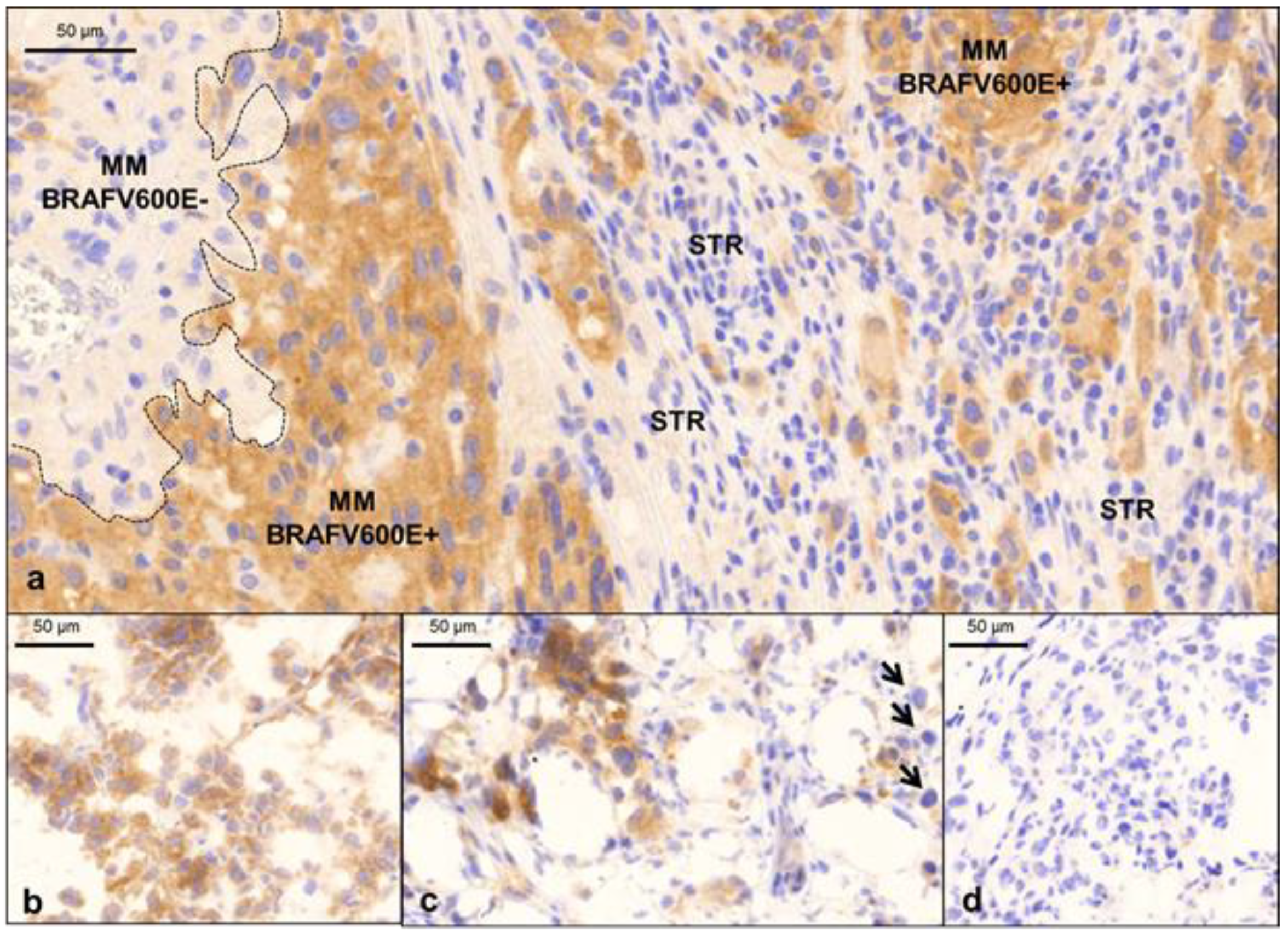 Cancers 12 00767 g003 Cancers 12 00767 g003