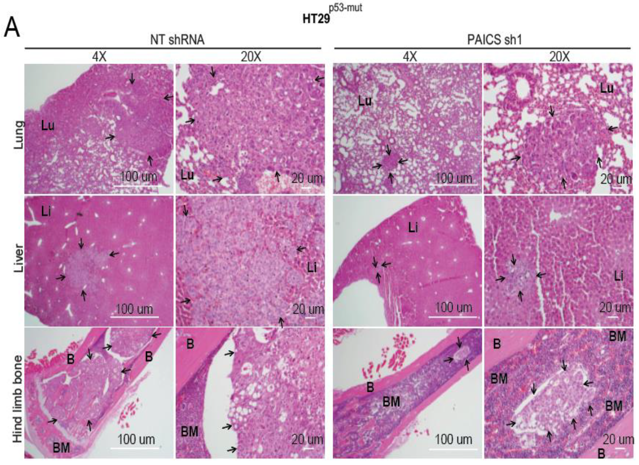 Cancers 12 00772 g005a Cancers 12 00772 g005a