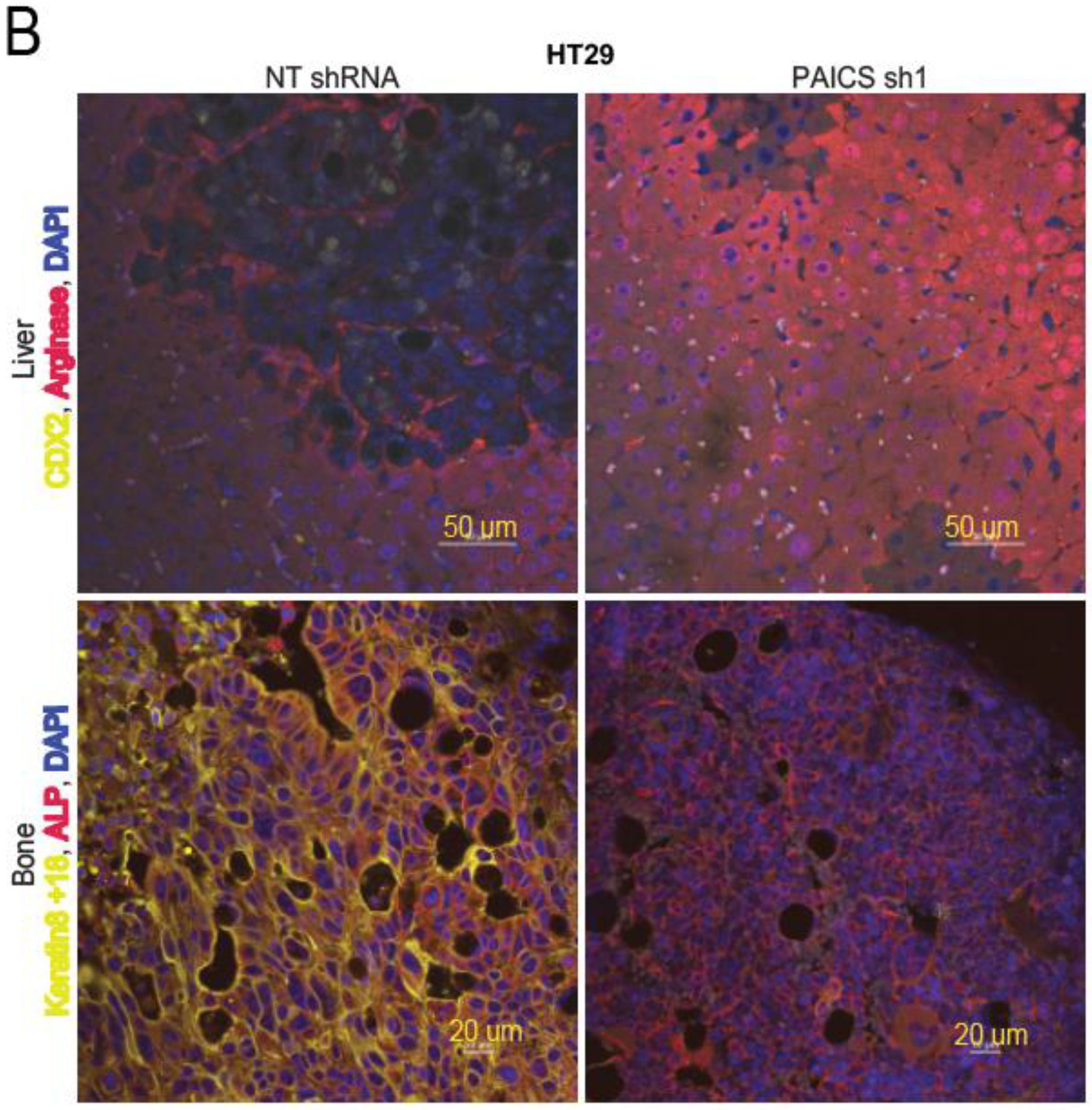 Cancers 12 00772 g005b Cancers 12 00772 g005b
