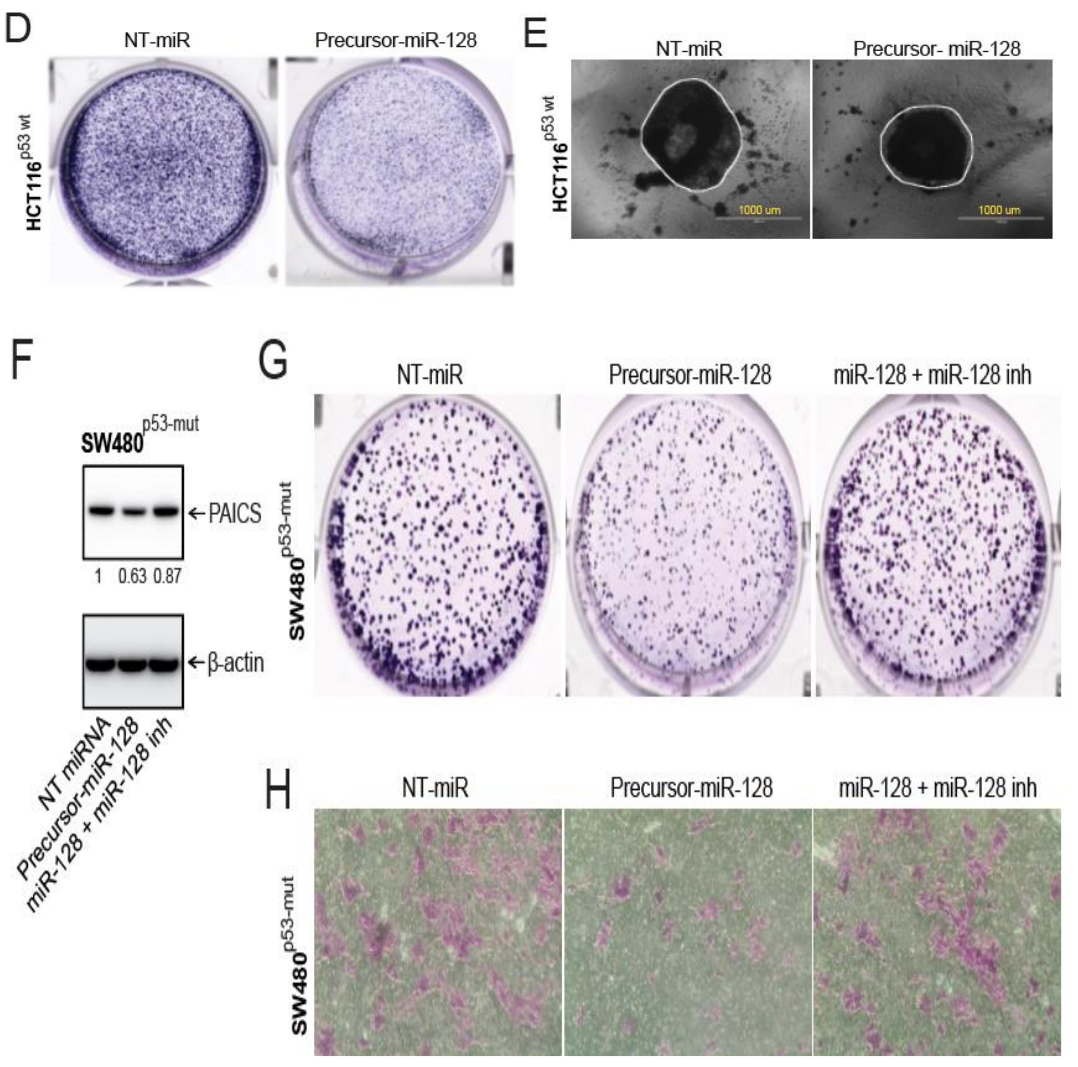 Cancers 12 00772 g007b Cancers 12 00772 g007b