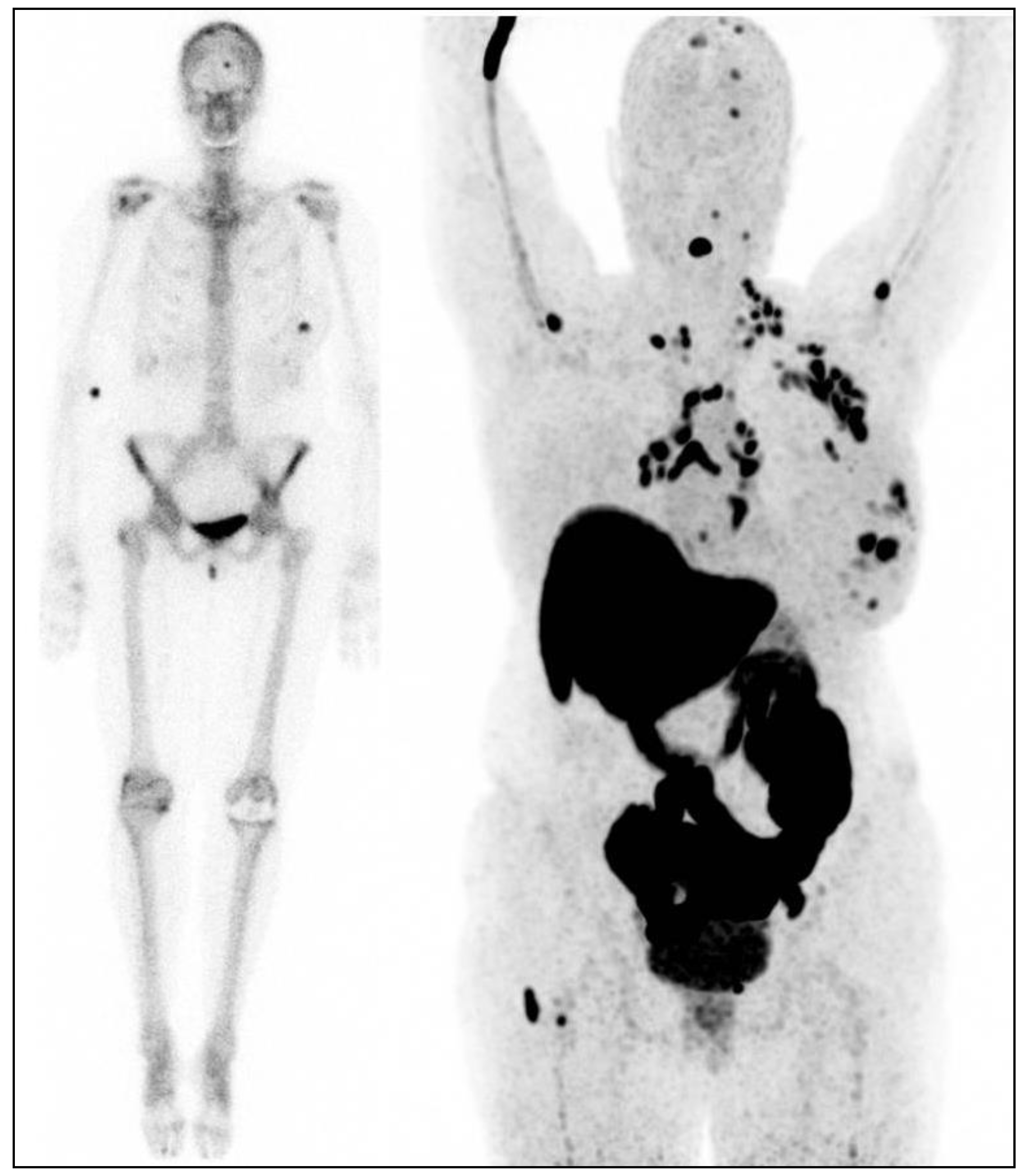 Cancers 12 00781 g001 Cancers 12 00781 g001