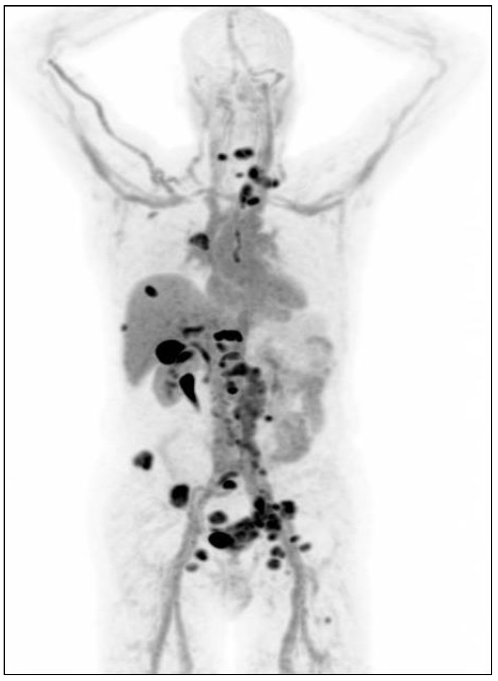 Cancers 12 00781 g002 Cancers 12 00781 g002