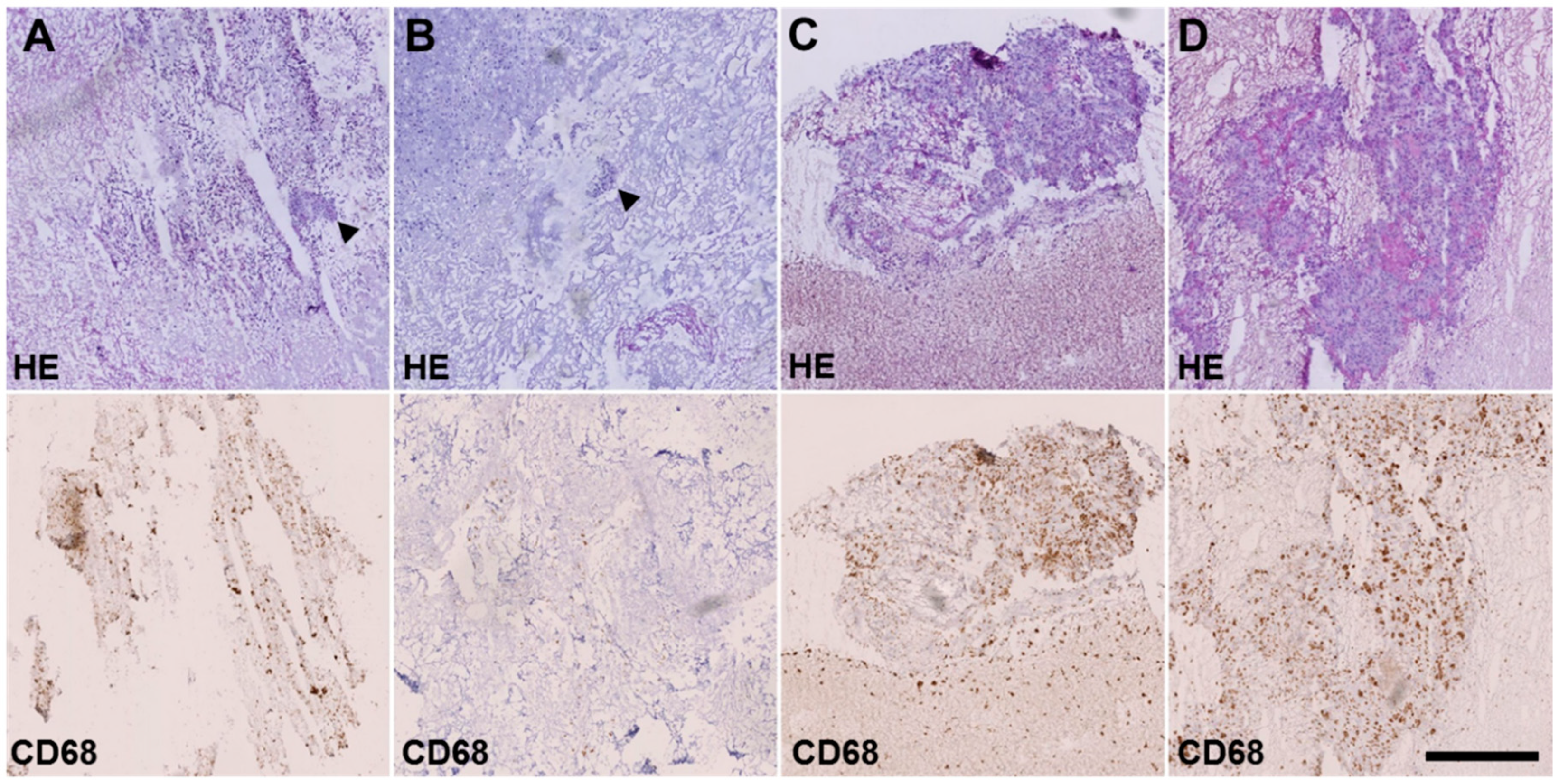 Cancers 12 00793 g003