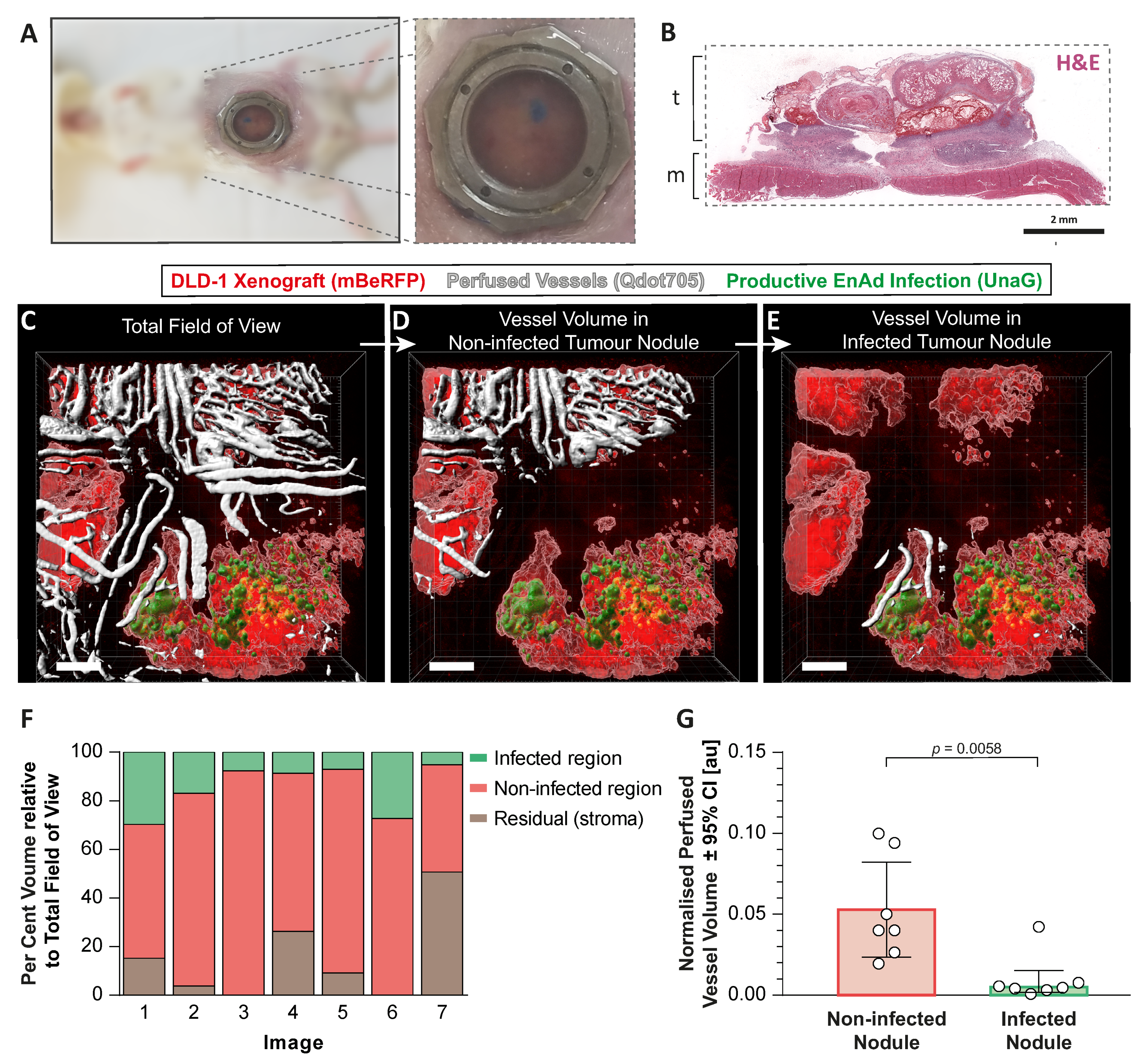 Cancers 12 00851 g005