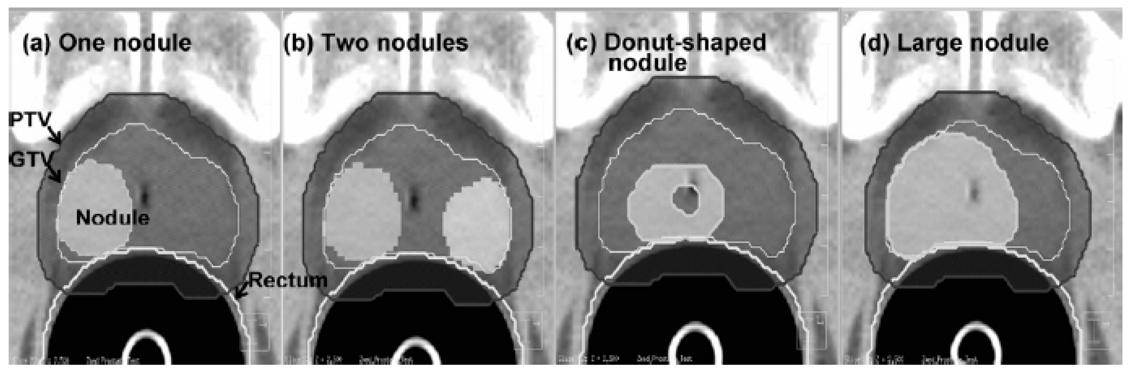 Cancers 12 00854 g004 Cancers 12 00854 g004