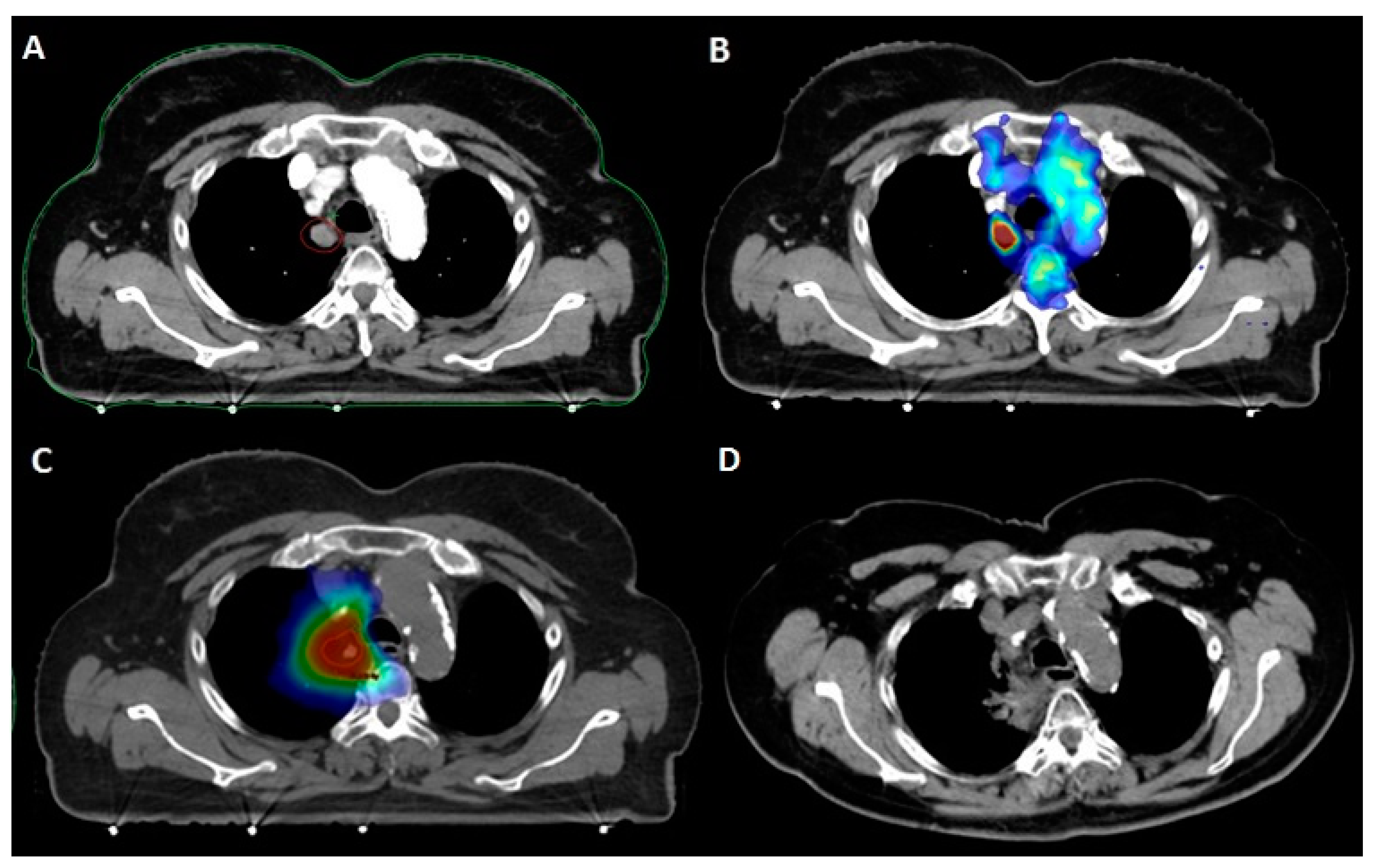 Cancers 12 00885 g002