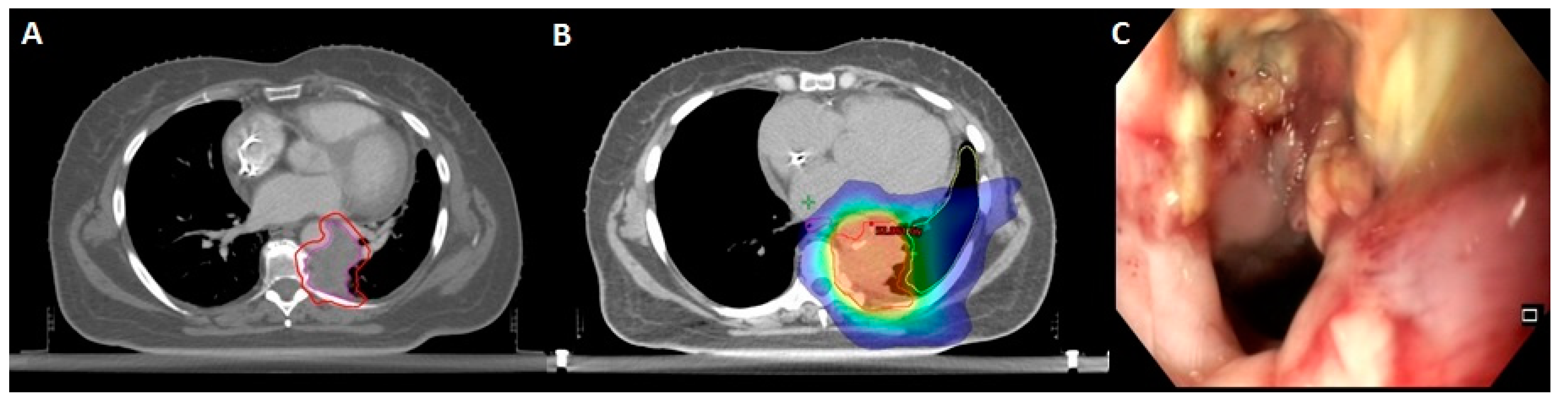 Cancers 12 00885 g003