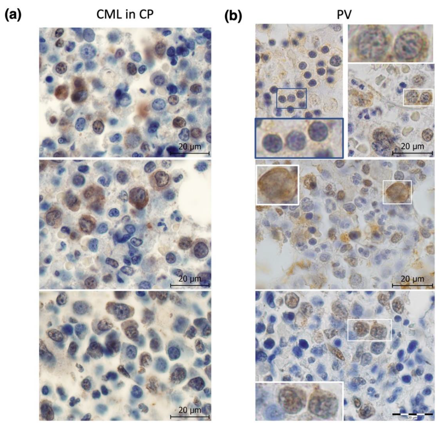 Cancers 12 00903 g002