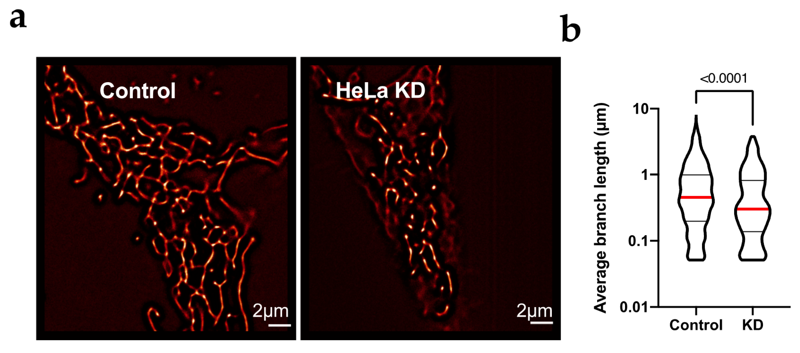 Inhibition of Kv10.1 Channels Sensitizes Mitochondria of