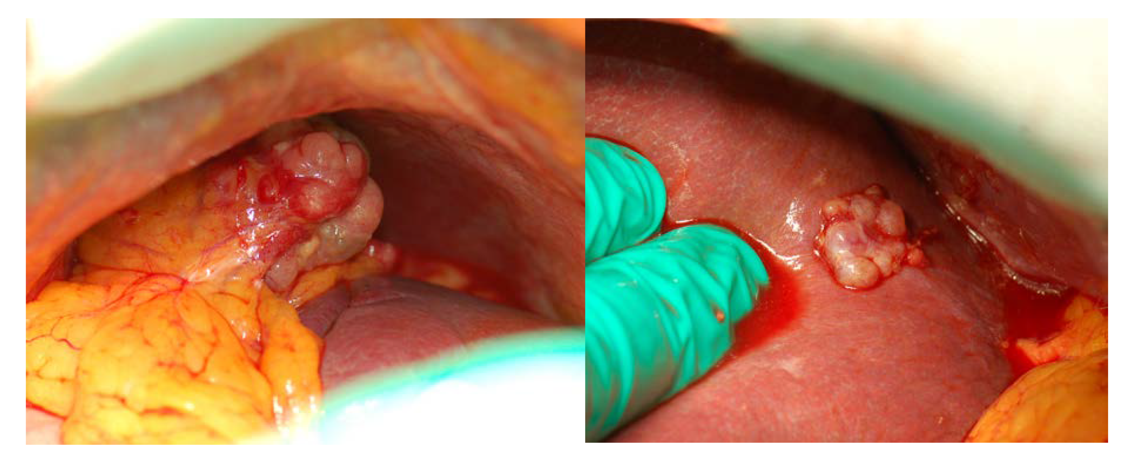 Cancers 12 00969 g003 Cancers 12 00969 g003