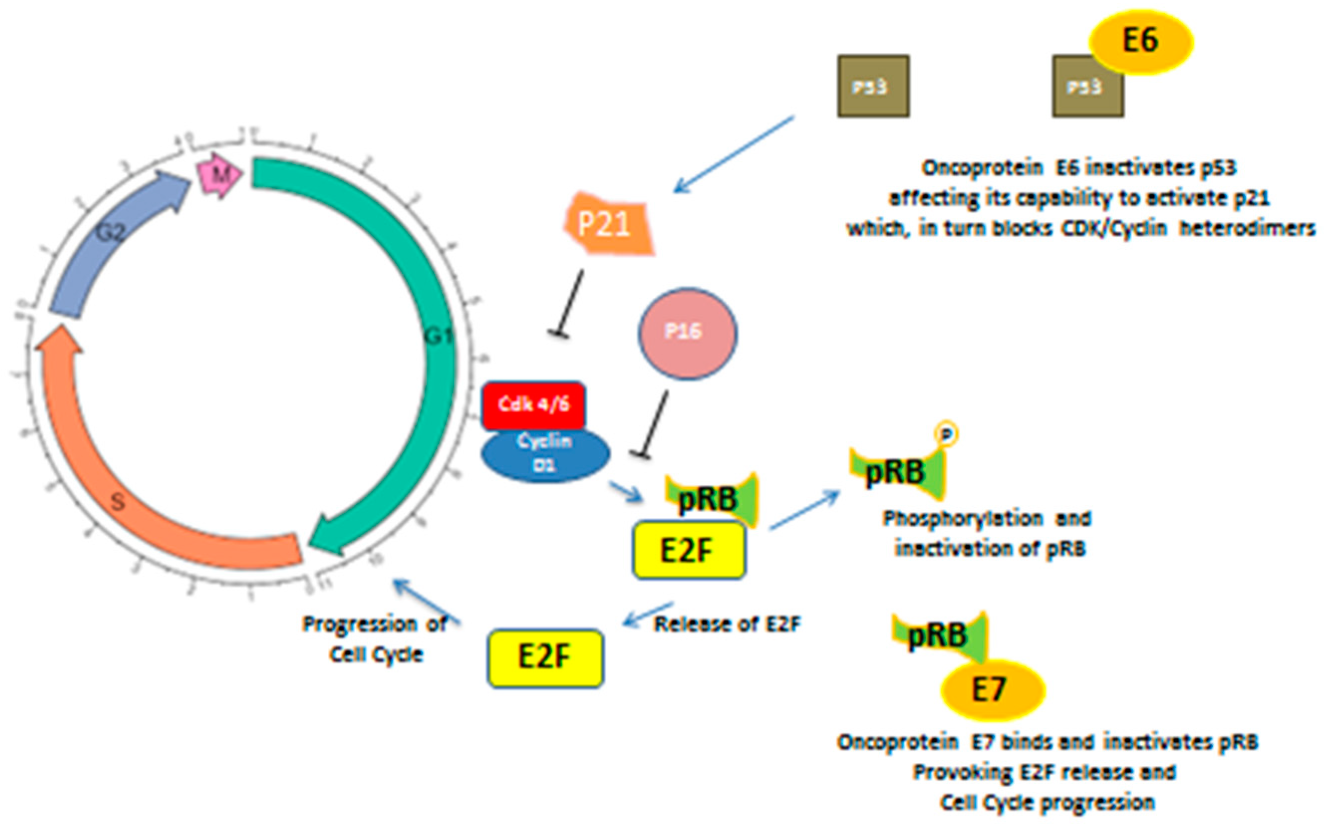 Human papillomavirus p Papilloma wart on the uvula, Human papillomavirus p16 expression
