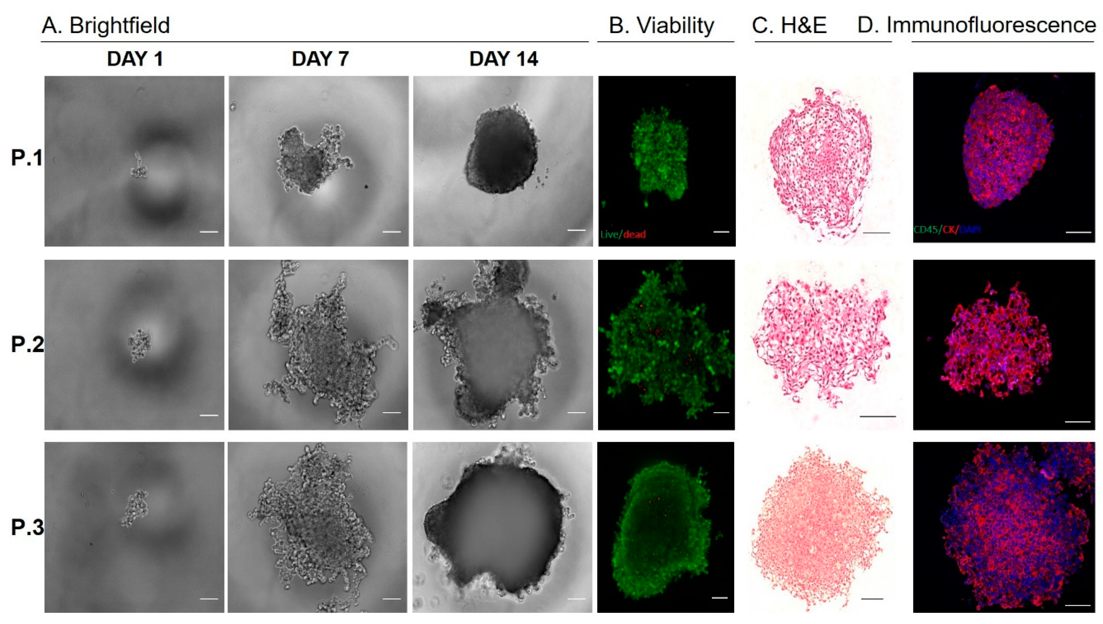 Cancers 12 01011 g004