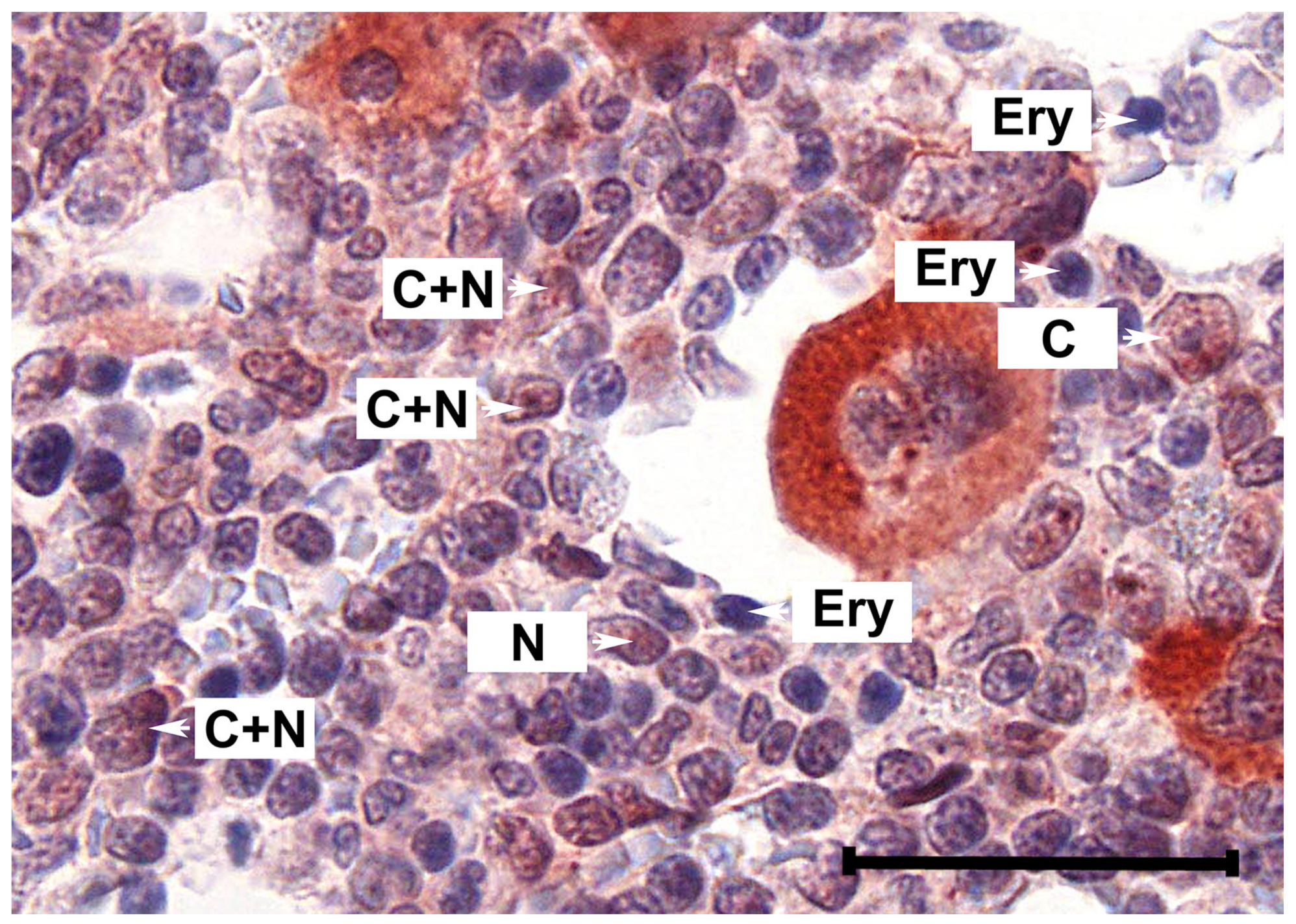 Cancers 12 01021 g0a1 Cancers 12 01021 g0a1