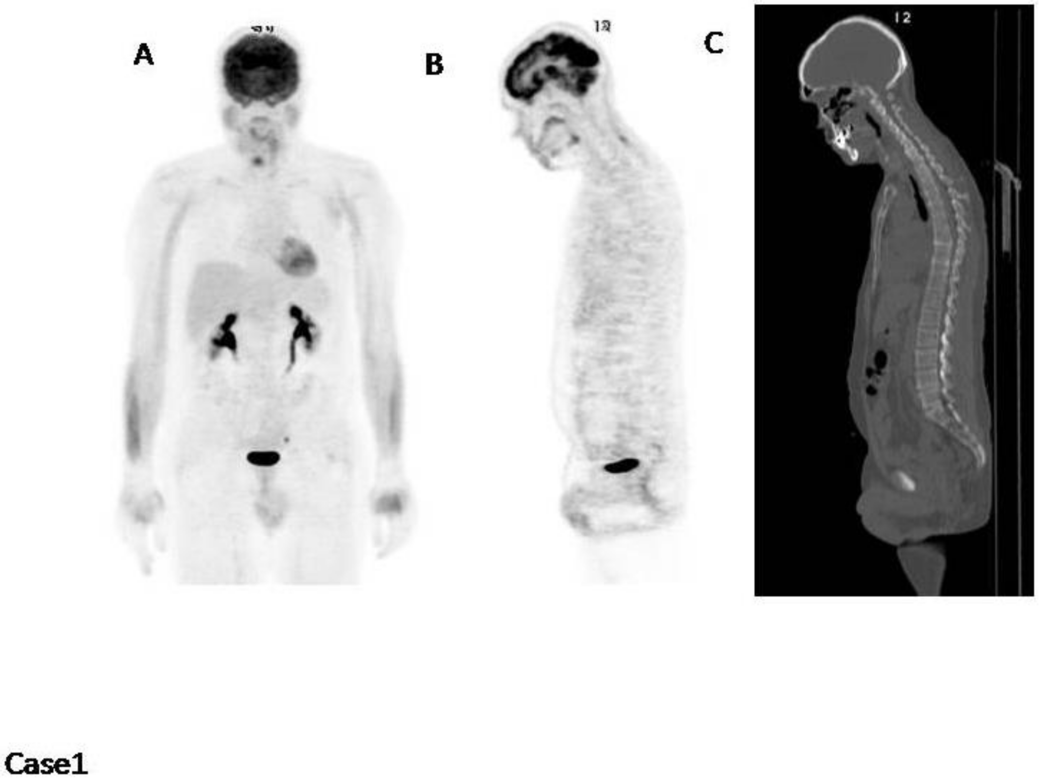 Cancers 12 01030 g001 Cancers 12 01030 g001