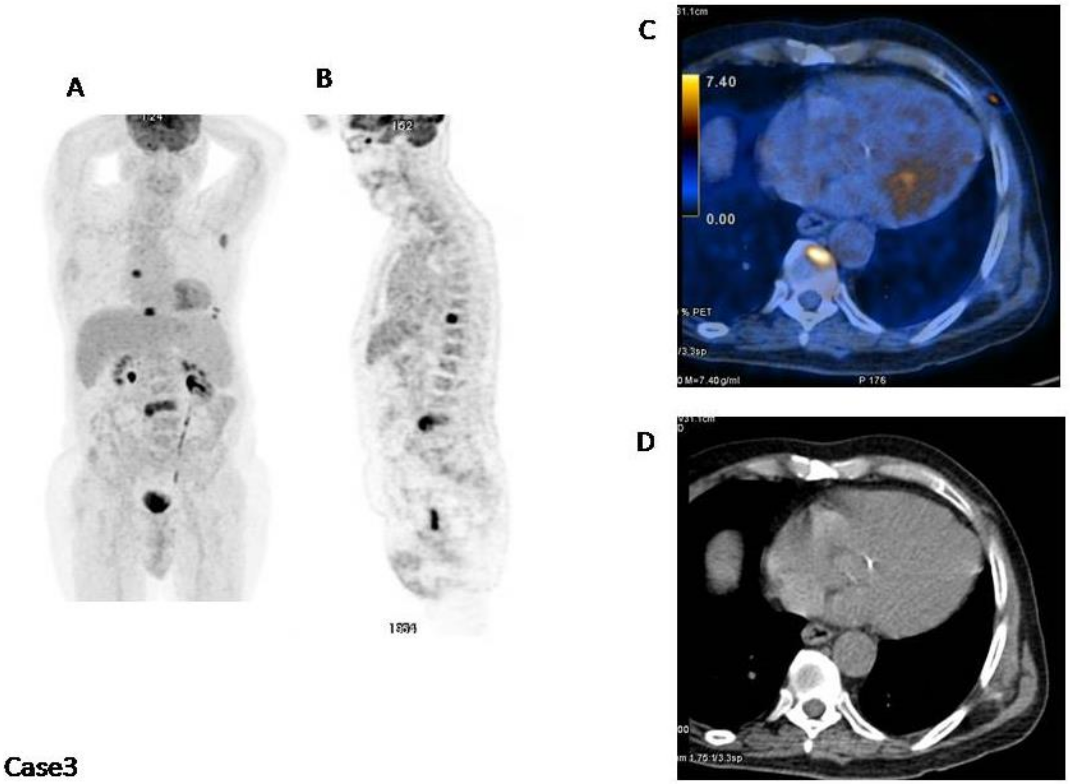 Cancers 12 01030 g003 Cancers 12 01030 g003