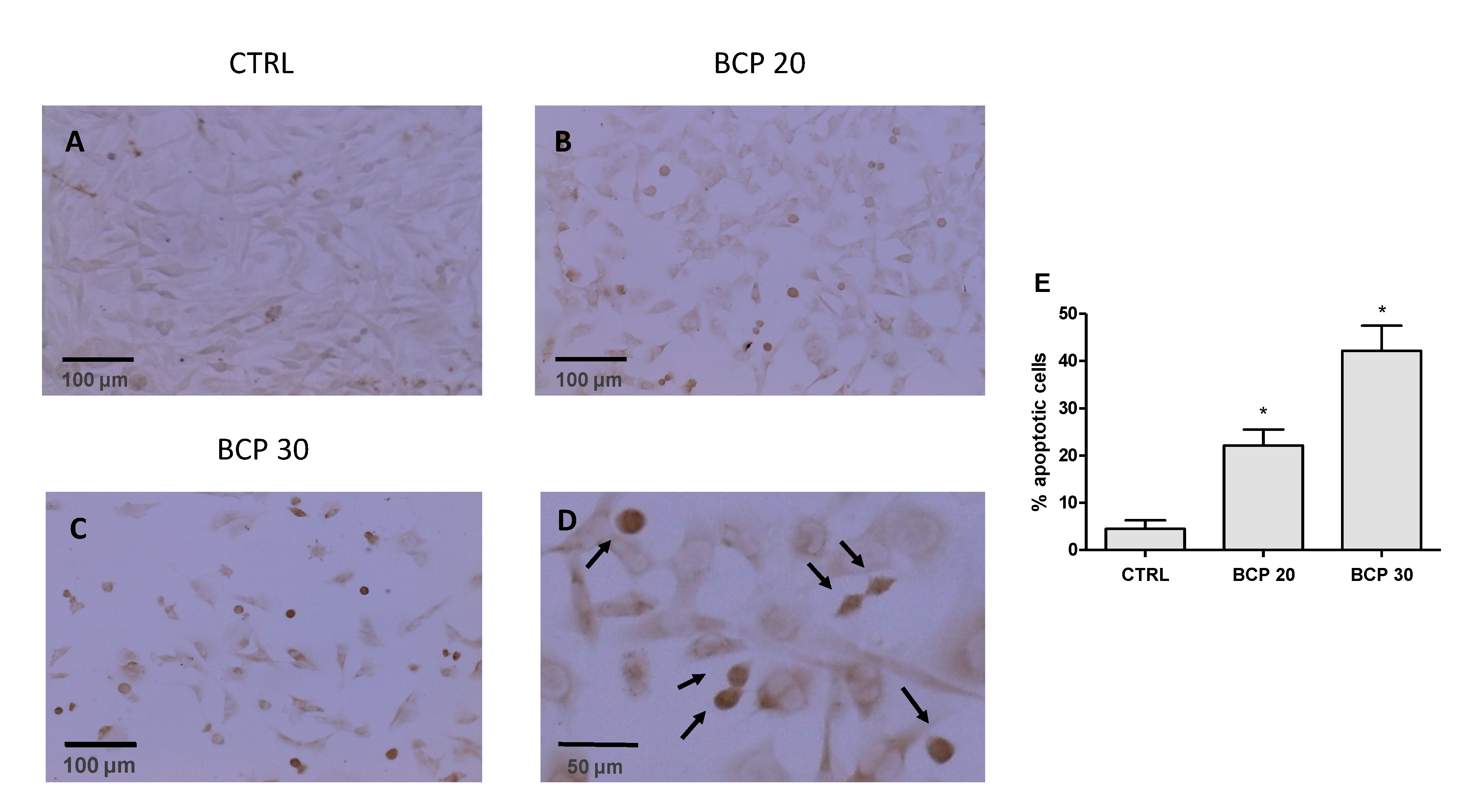 Cancers 12 01038 g002 Cancers 12 01038 g002