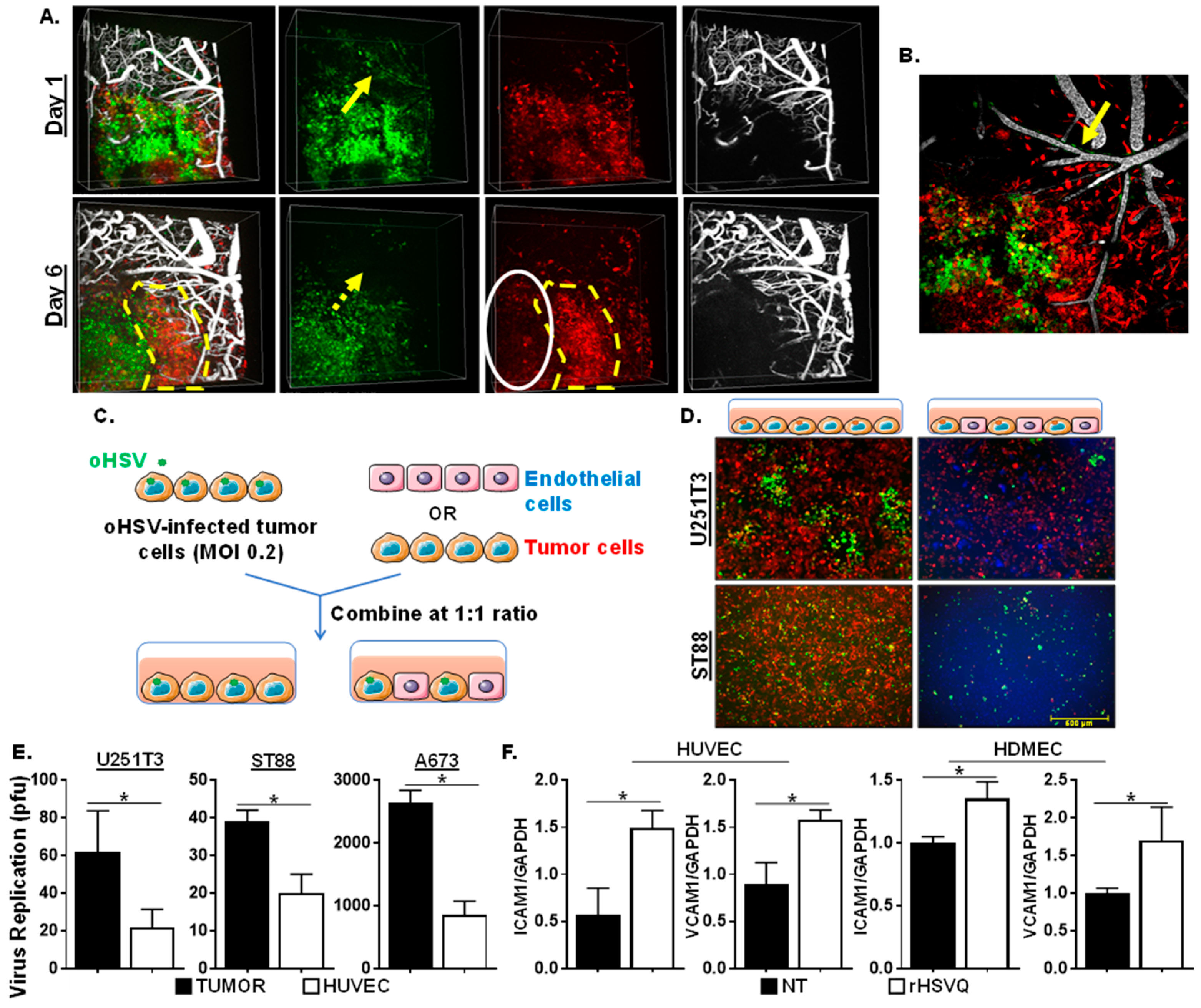 Cancers Free Full Text Enhancing Antitumor Efficacy Of Heavily Vascularized Tumors By Rambo Virus Through Decreased Tumor Endothelial Cell Activation Cancers Free Full Text Enhancing Antitumor Efficacy Of Heavily Vascularized Tumors By Rambo Virus Through Decreased Tumor Endothelial Cell Activation