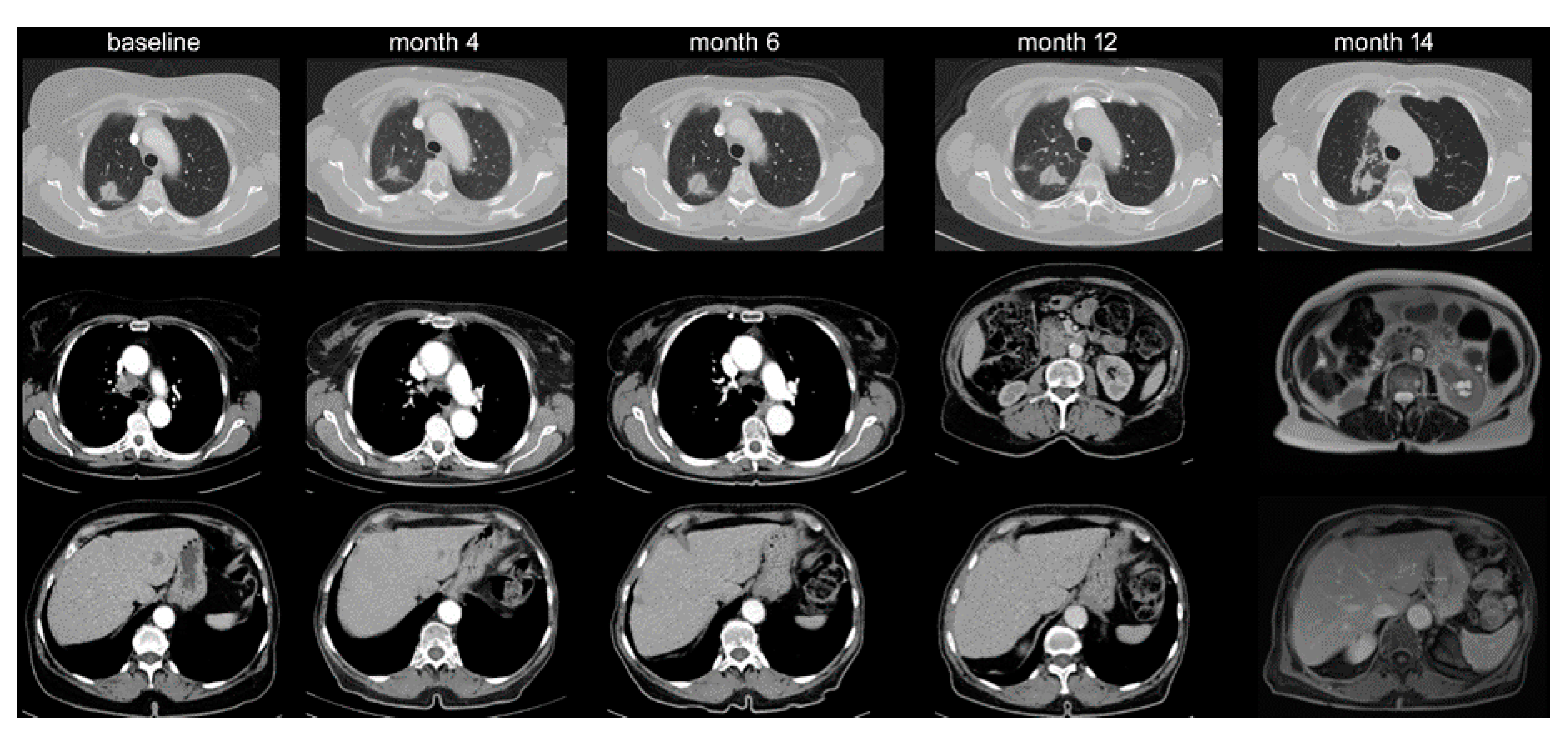 Cancers 12 01046 g003 Cancers 12 01046 g003