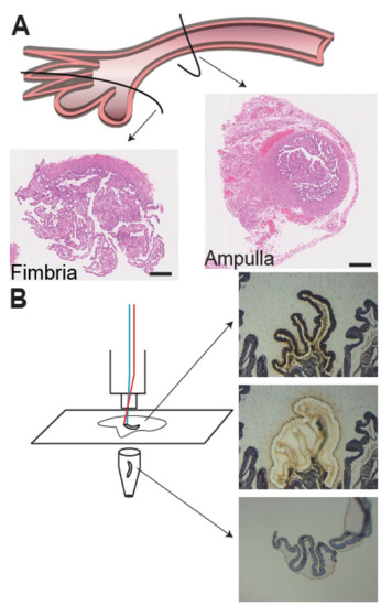 Cancers | Free Full-Text | Integrative Transcriptome Analyses of the