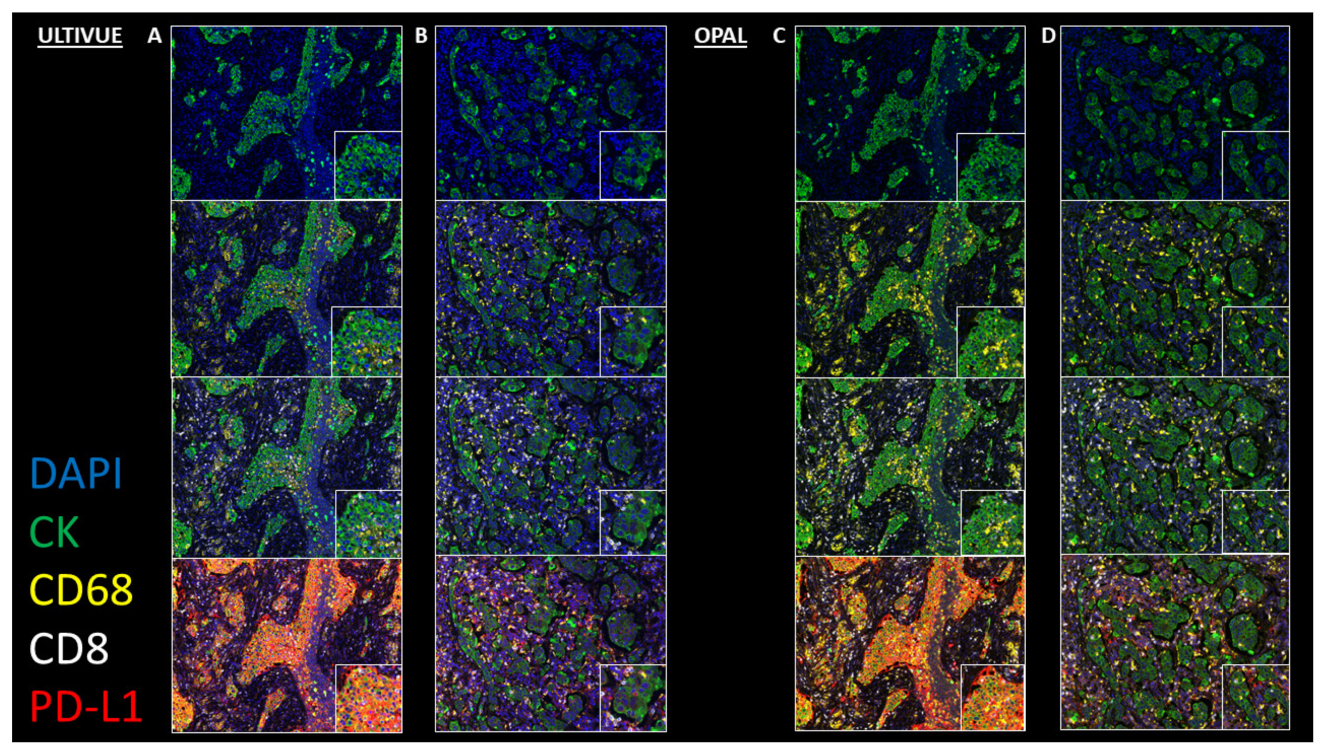 Cancers 12 01114 g003 Cancers 12 01114 g003