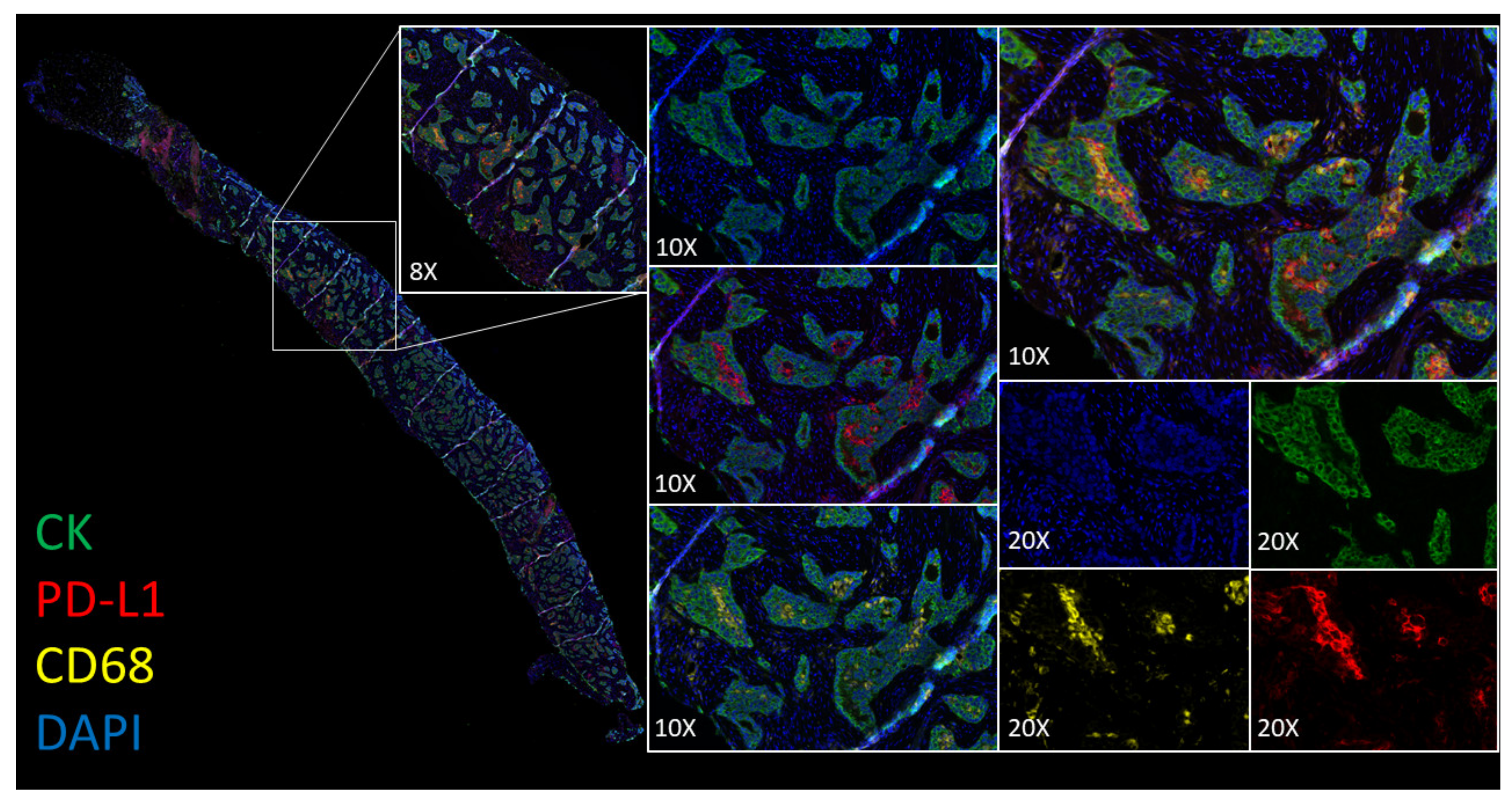 Cancers 12 01114 g005 Cancers 12 01114 g005