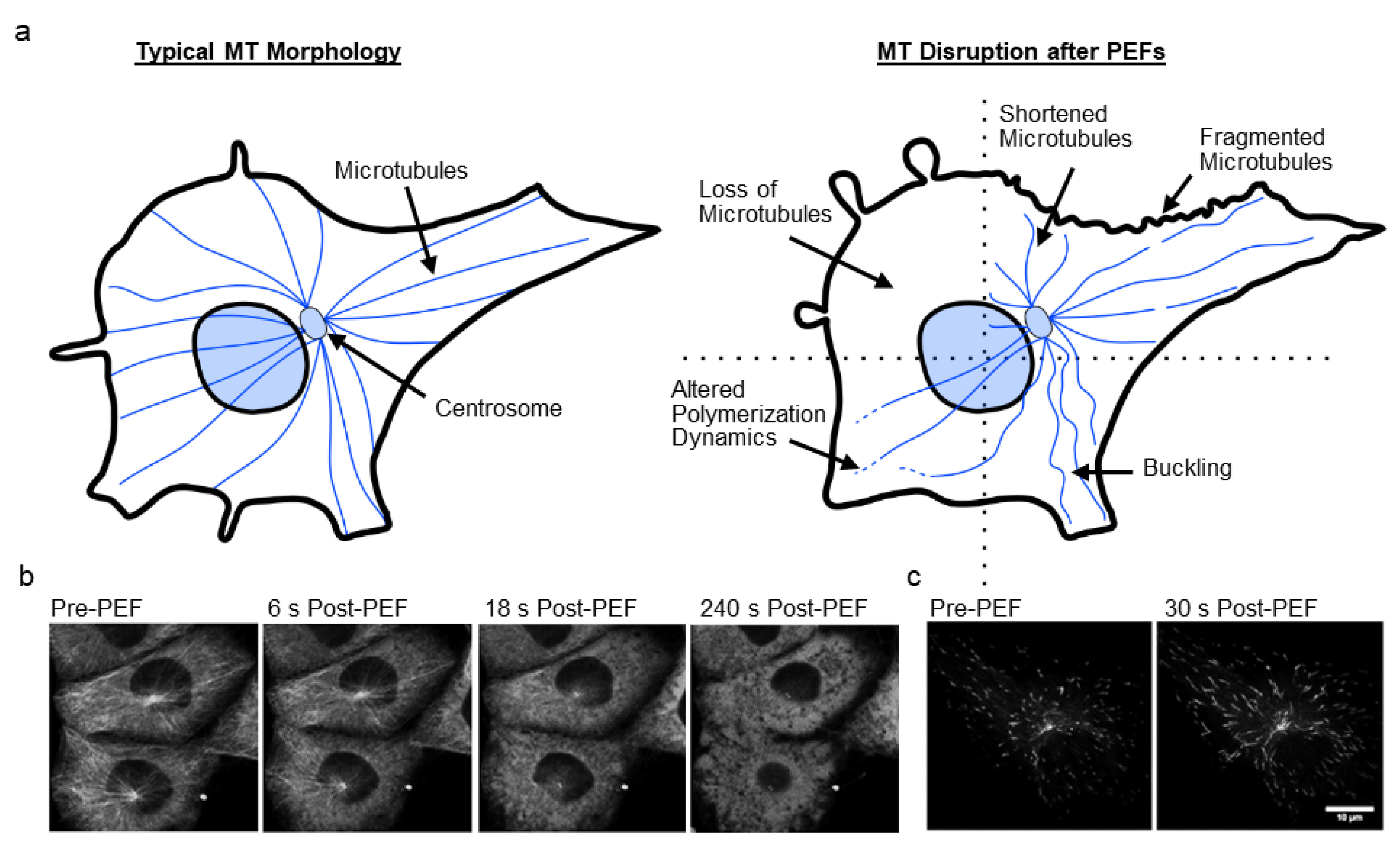 Cancers Free FullText Cytoskeletal Disruption after