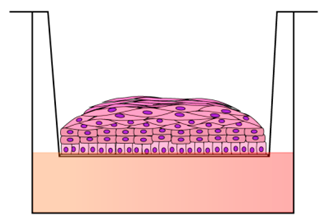 Cancers 12 01150 i002