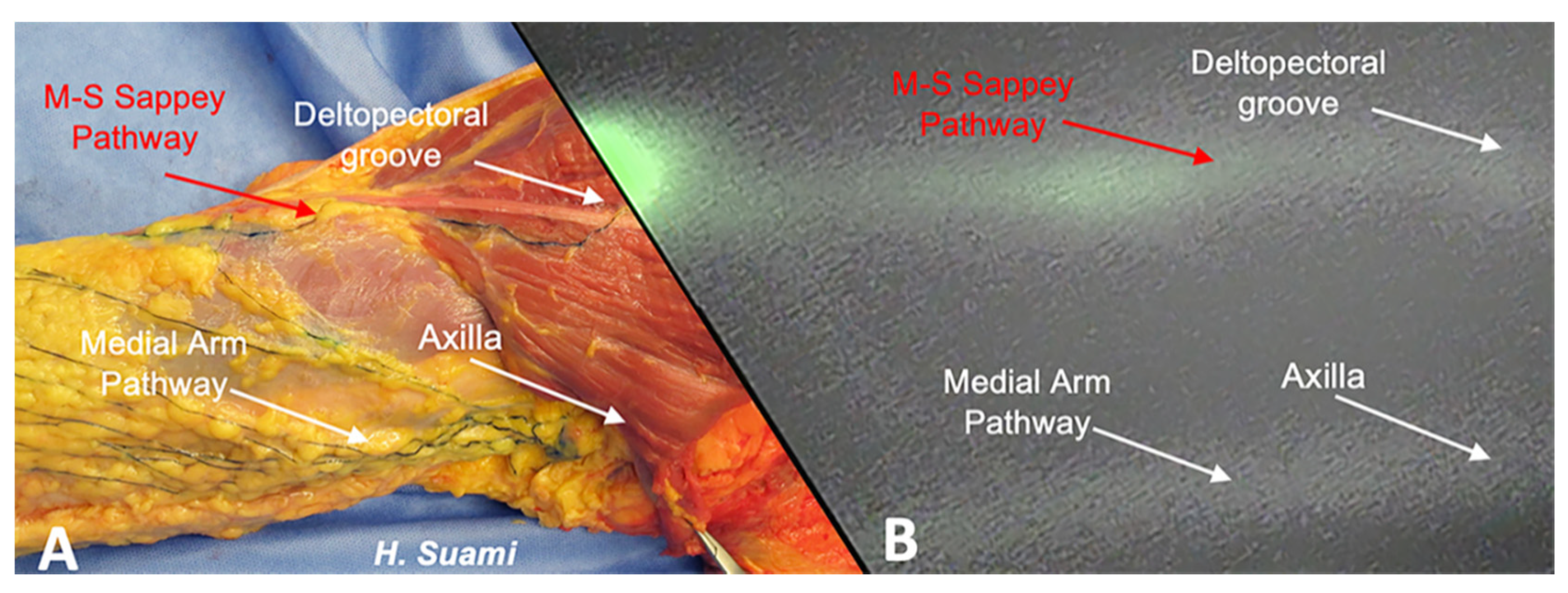 Cancers 12 01195 g001 Cancers 12 01195 g001