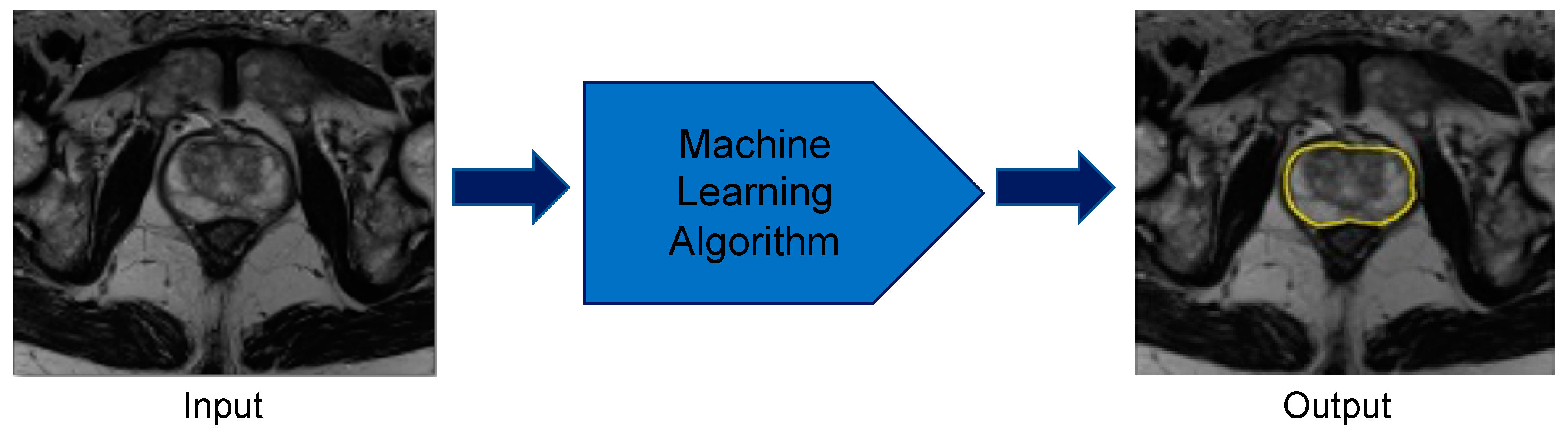 Cancers 12 01204 g003 Cancers 12 01204 g003