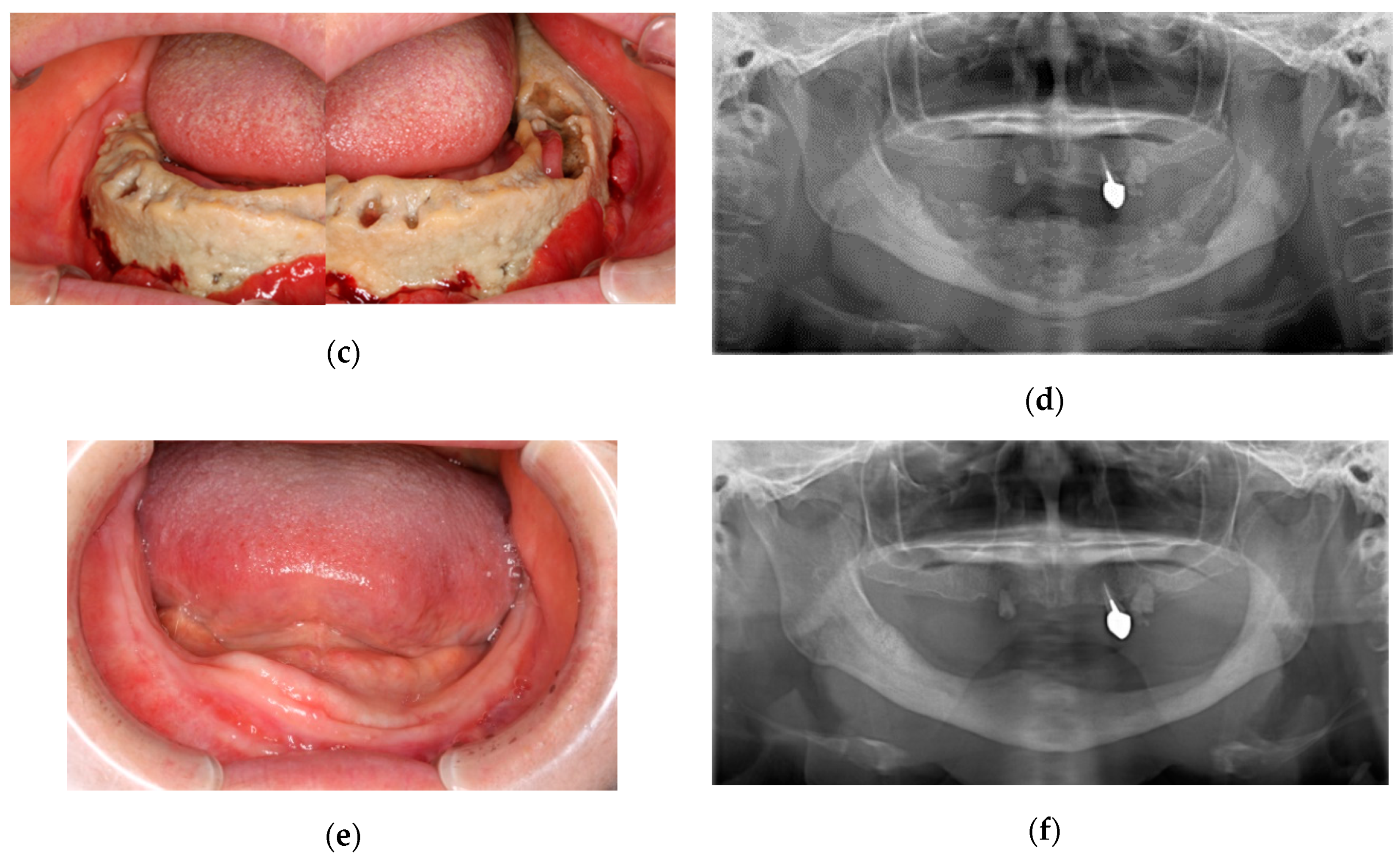 Cancers 12 01209 g001b Cancers 12 01209 g001b