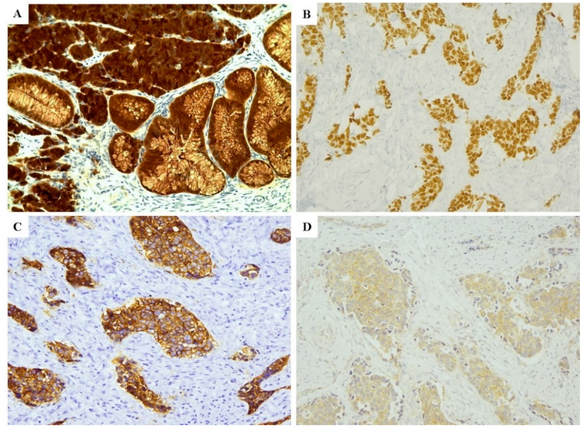 Cancers 12 01211 g003