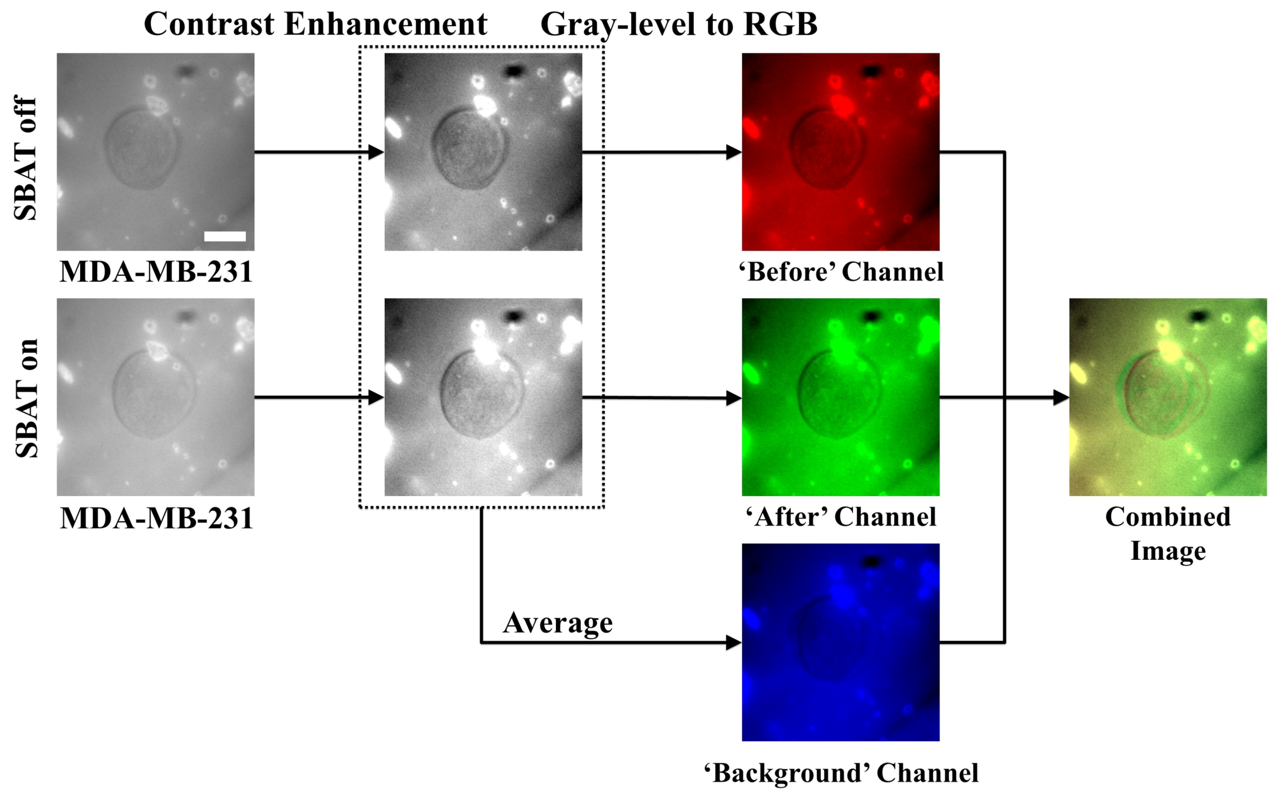 Cancers 12 01212 g003 Cancers 12 01212 g003