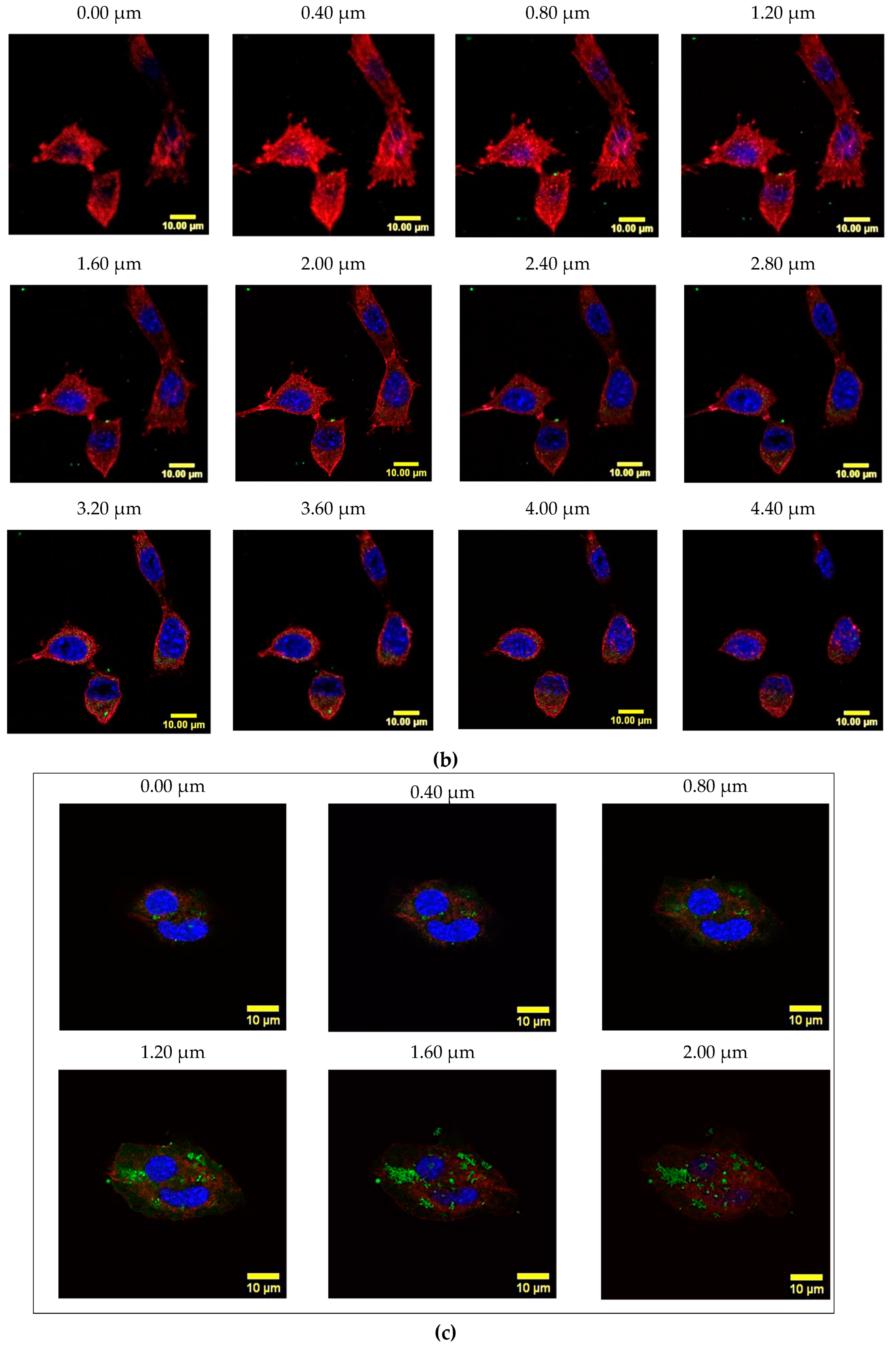 Cancers 12 01215 g011b Cancers 12 01215 g011b