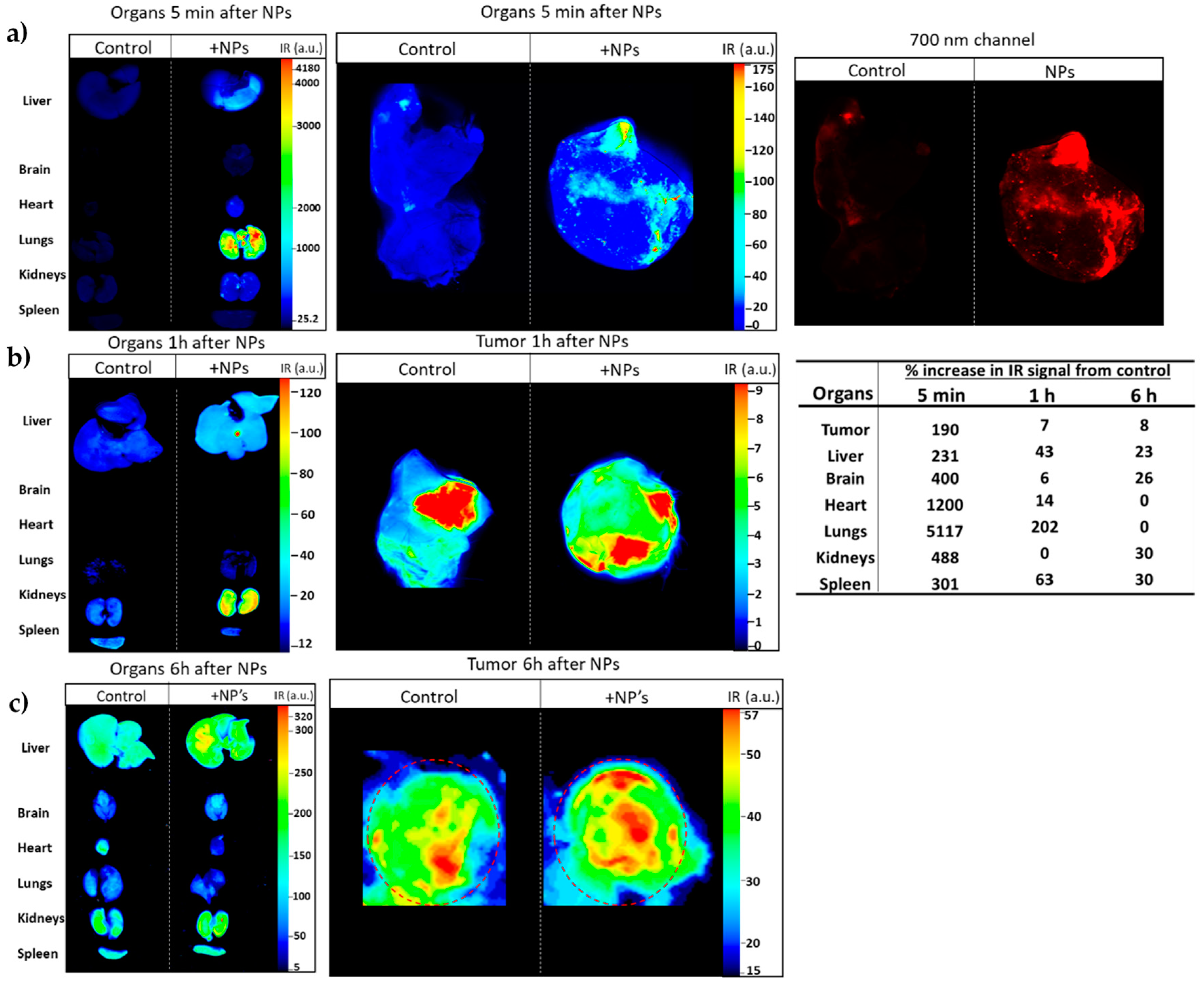 Cancers 12 01215 g013 Cancers 12 01215 g013