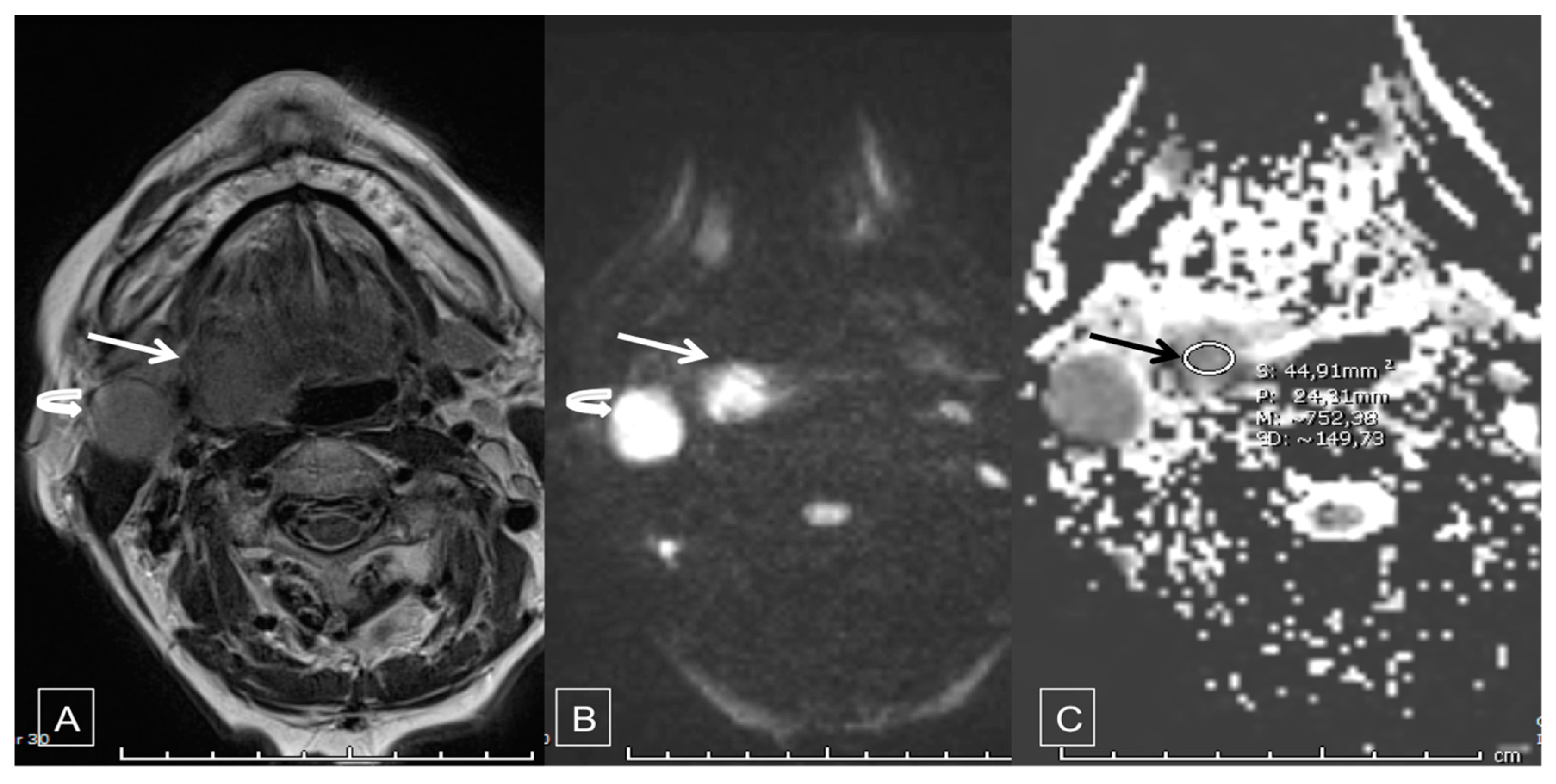 Cancers 12 01234 g001 Cancers 12 01234 g001
