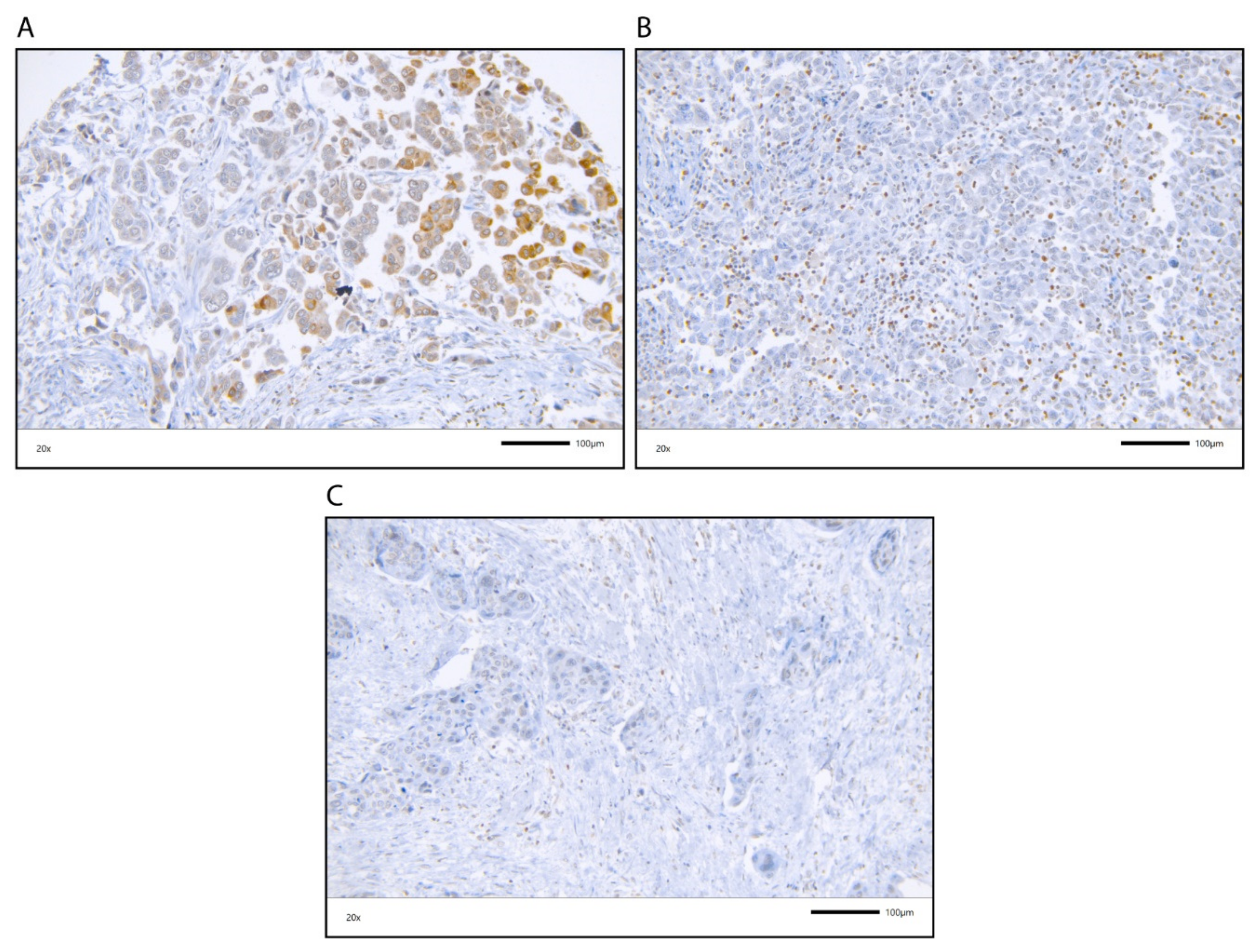 Cancers 12 01253 g001