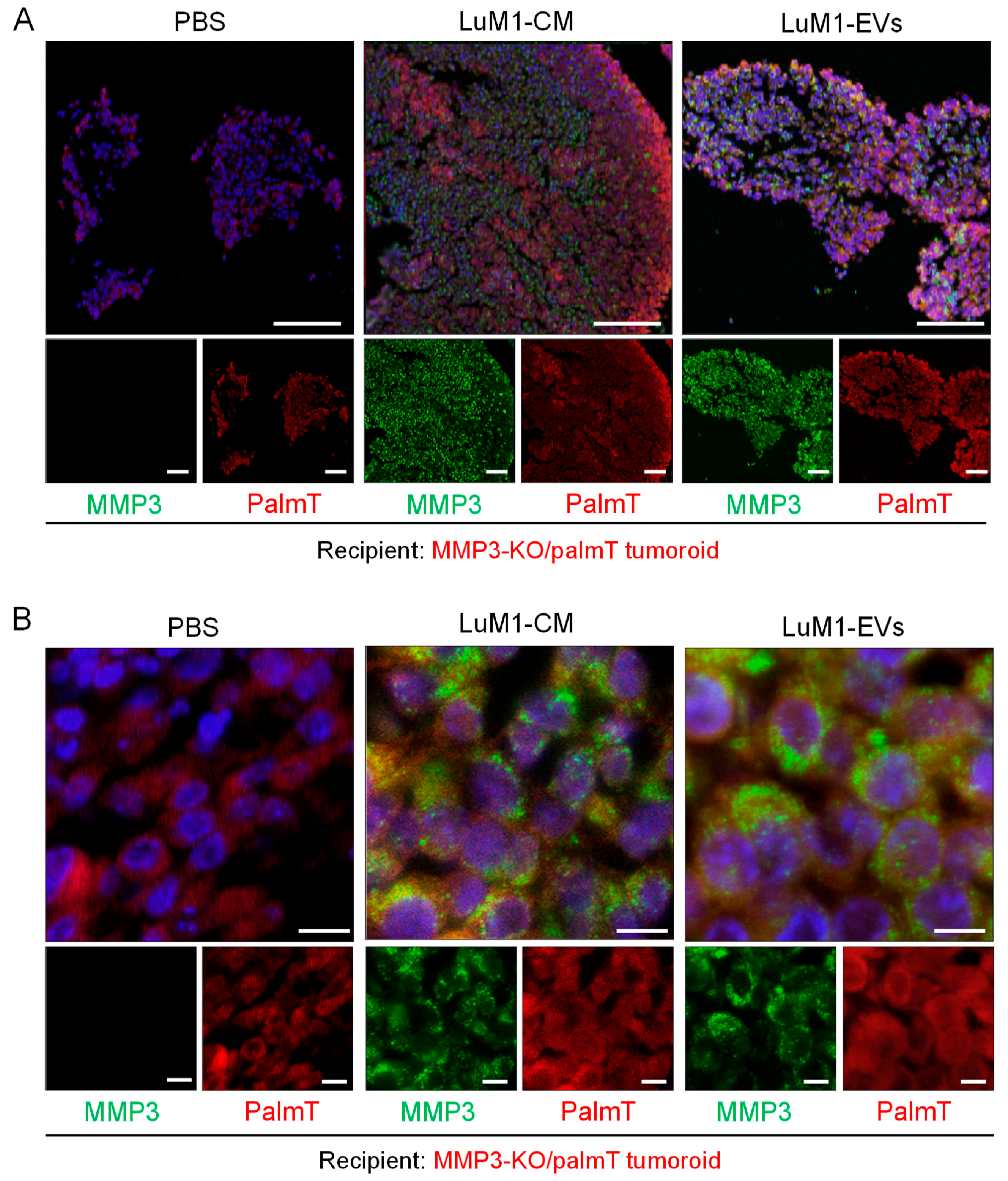 Cancers 12 01260 g008