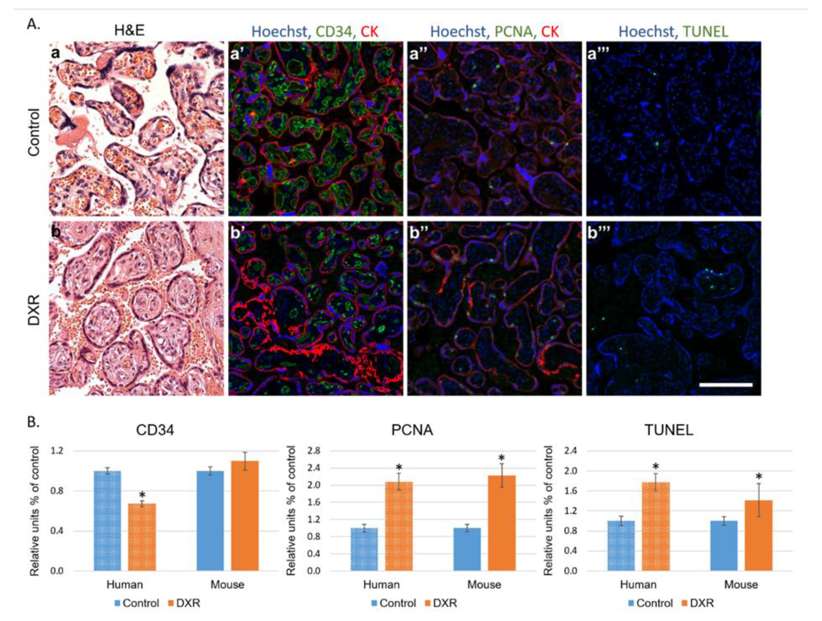 Cancers 12 01277 g004
