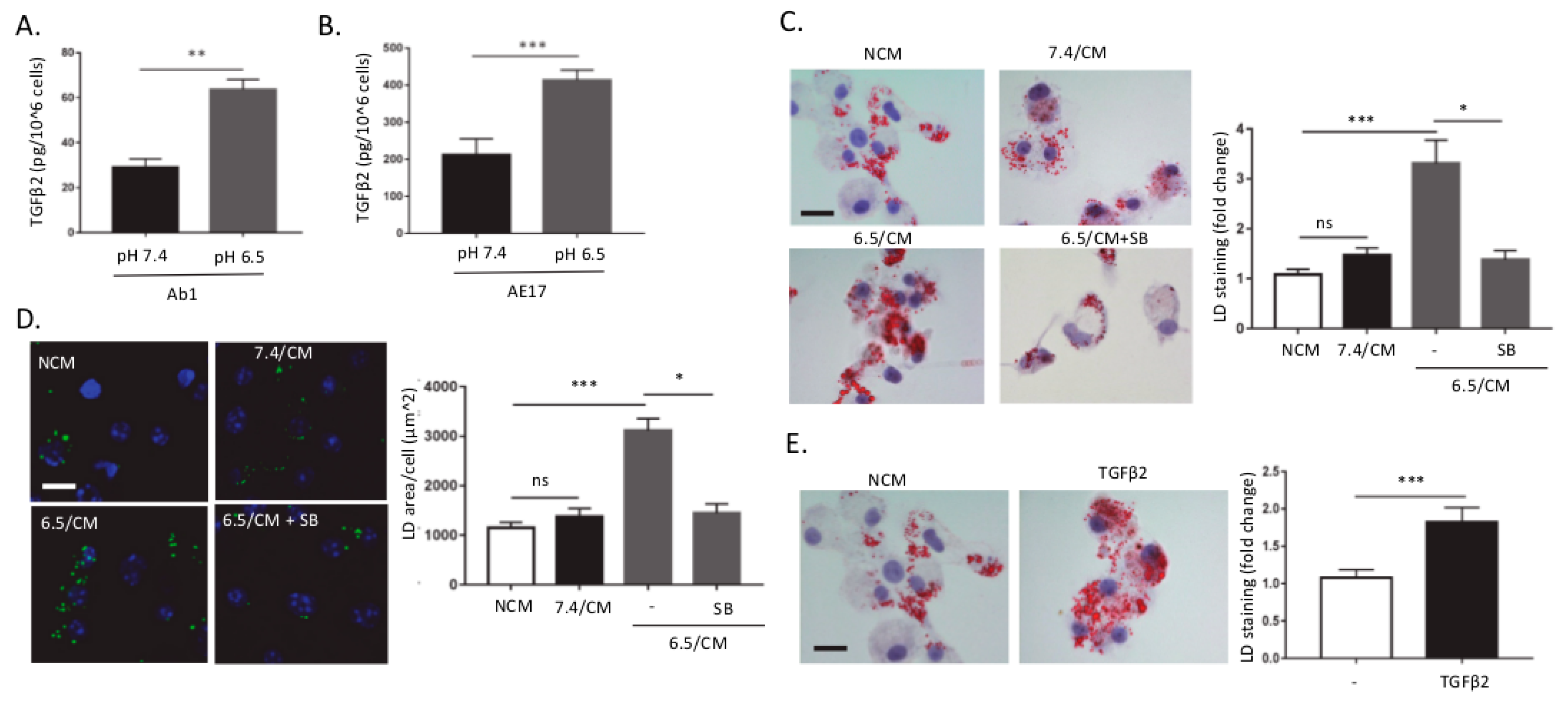 stage 4 lung cancer spread to brain and bones