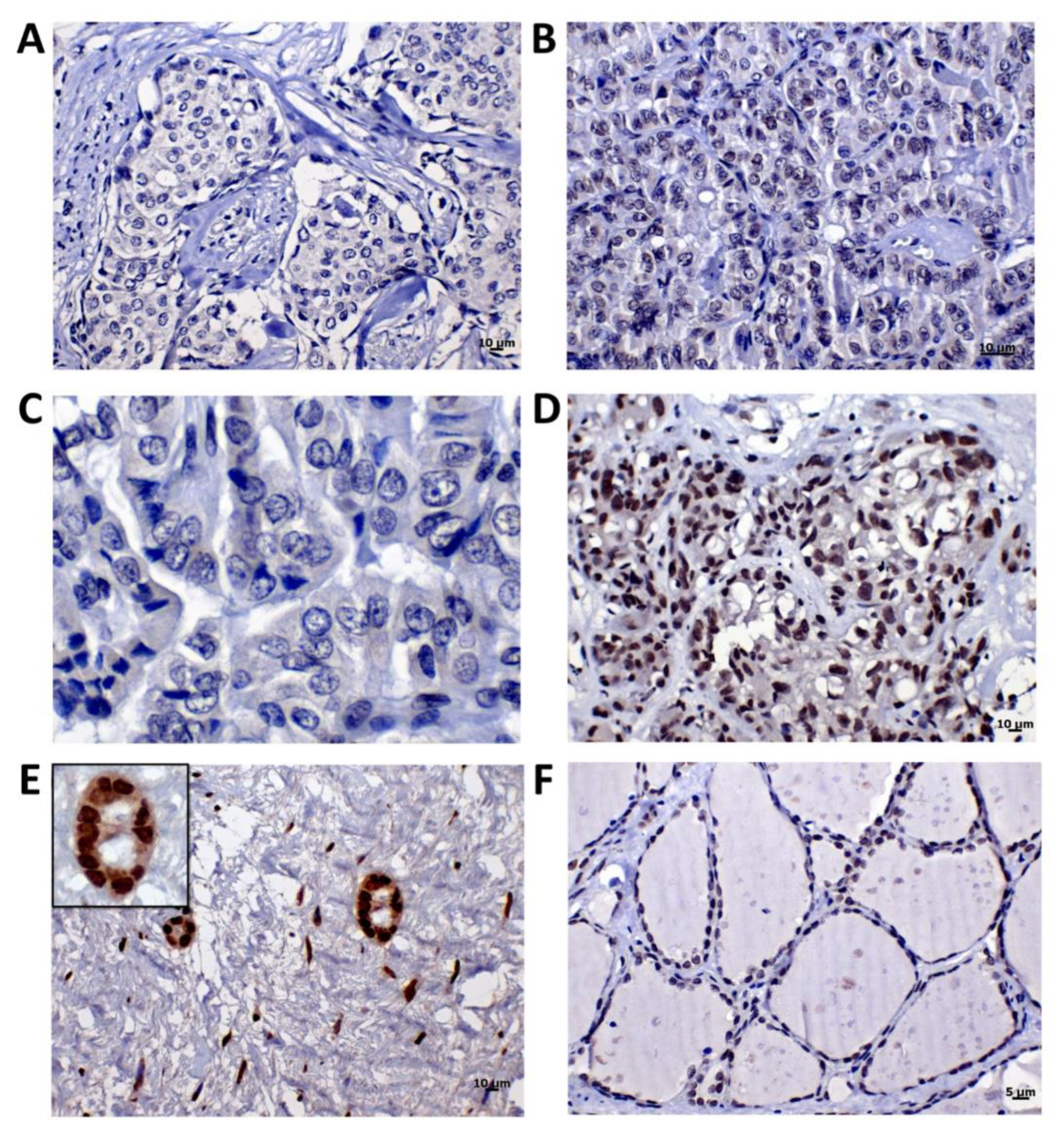 Cancers 12 01289 g003