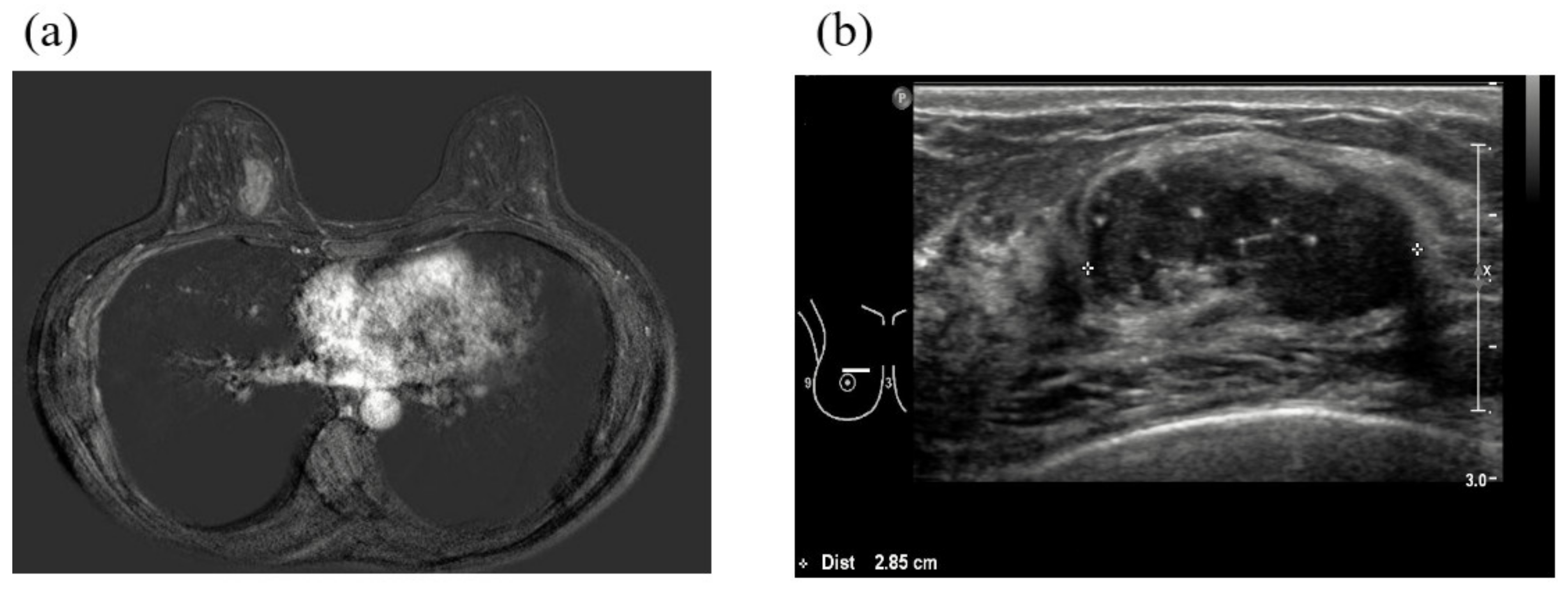Cancers 12 01306 g002 Cancers 12 01306 g002