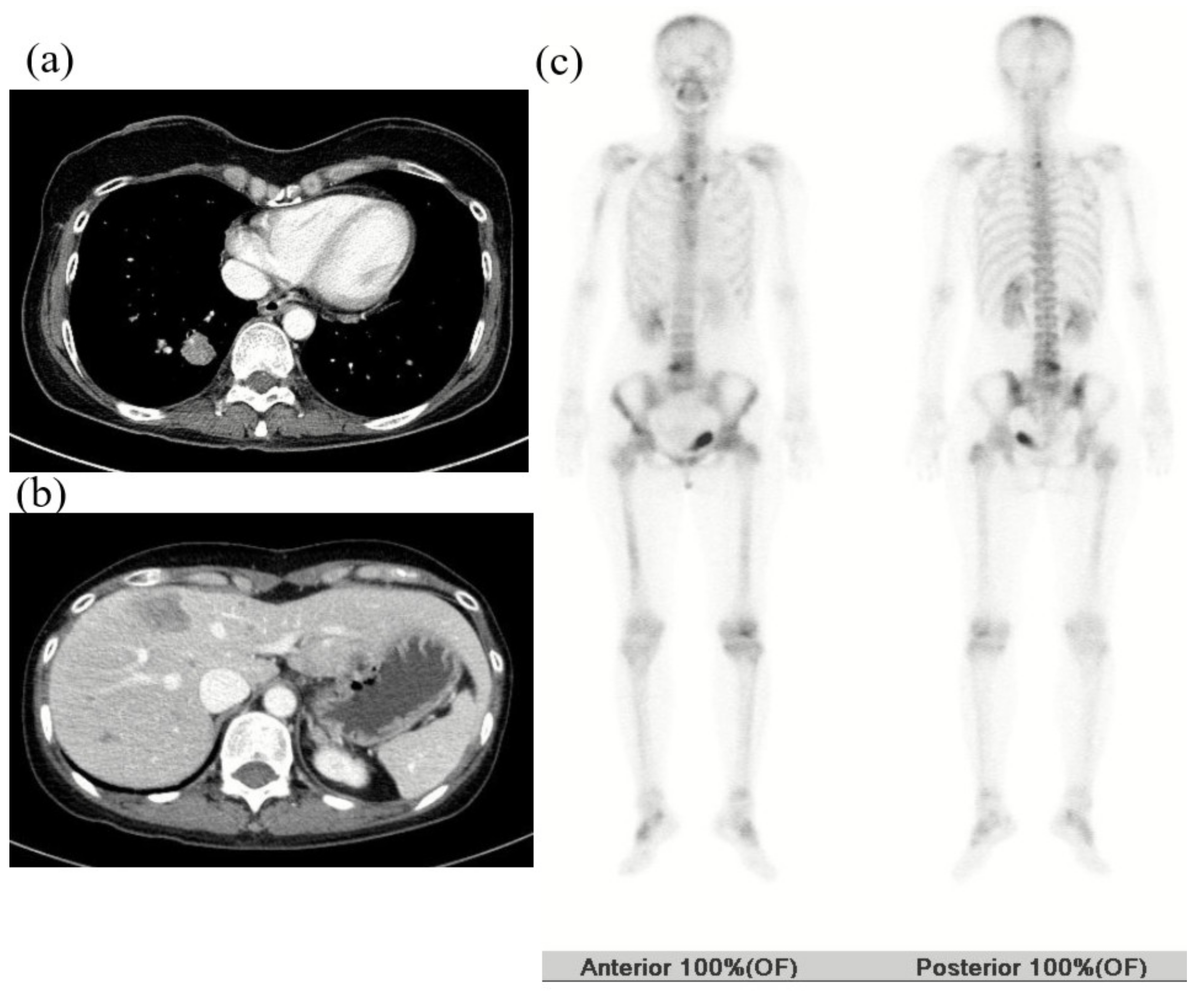 Cancers 12 01306 g003 Cancers 12 01306 g003