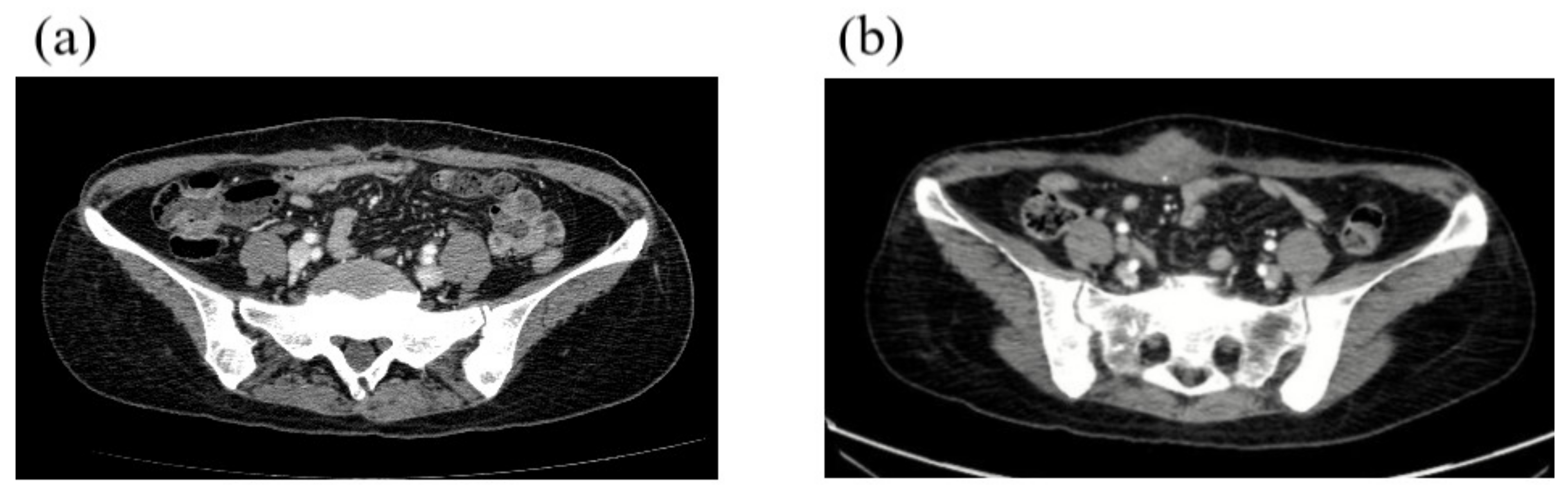 Cancers 12 01306 g004 Cancers 12 01306 g004